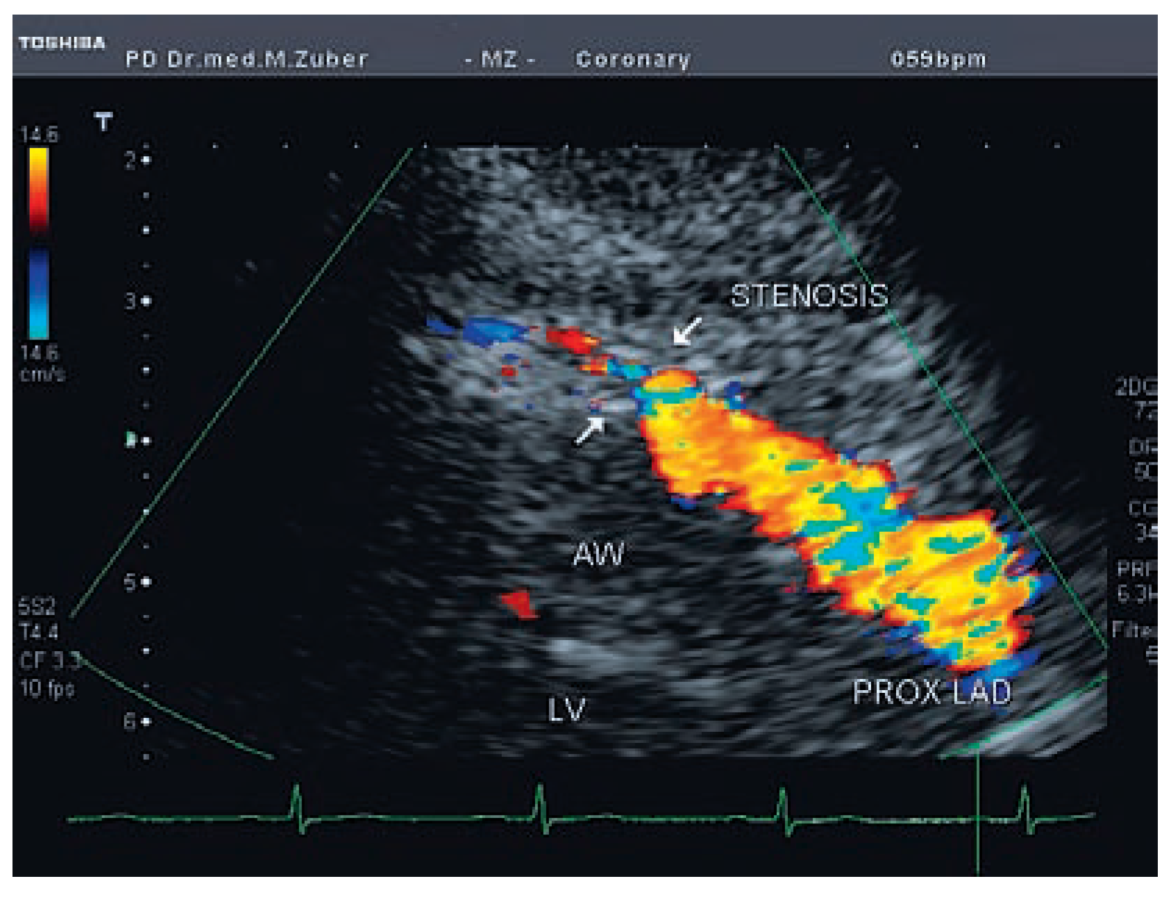 Cardiovascmed 11 00326 g001 Cardiovascmed 11 00326 g001