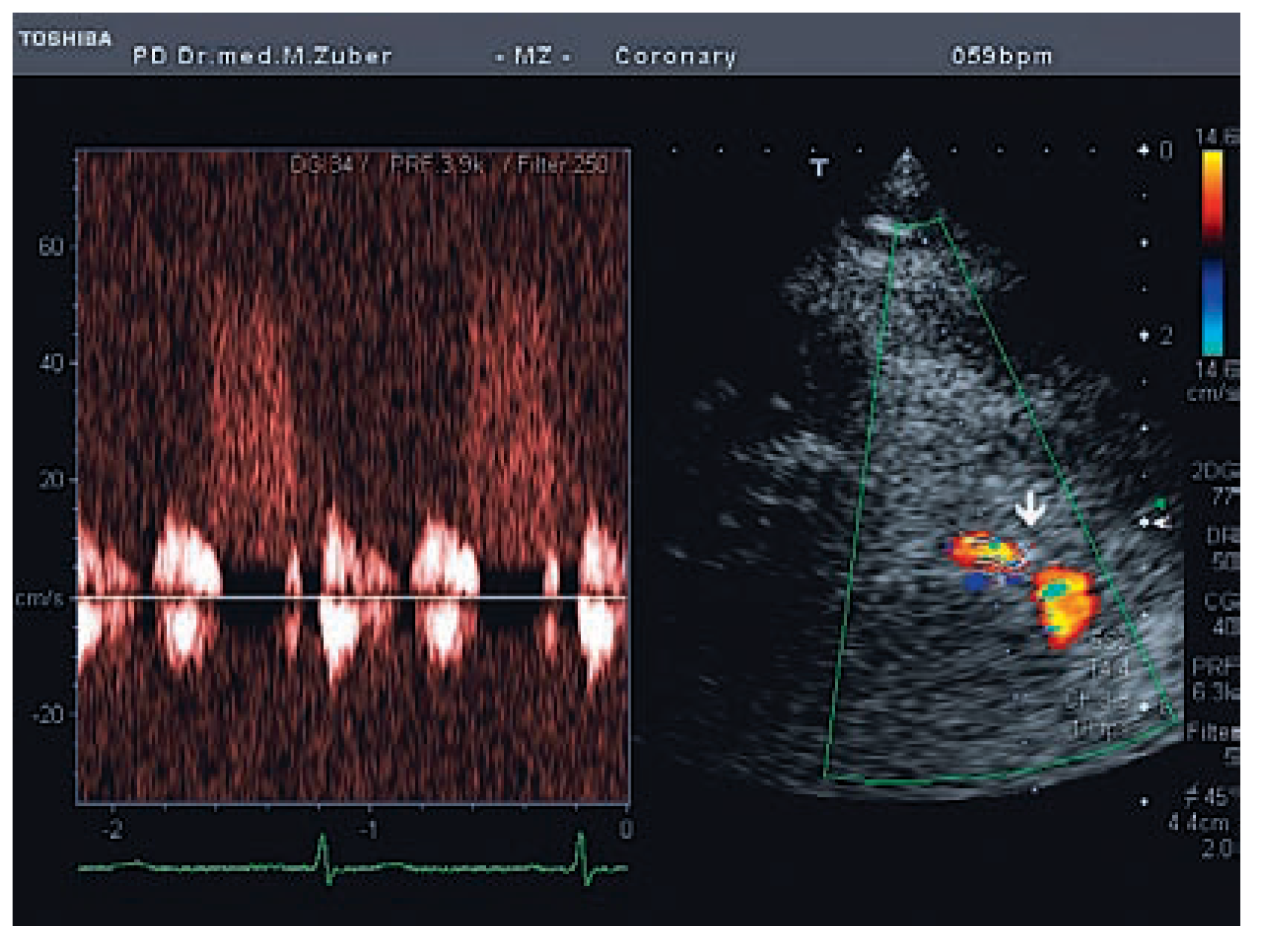 Cardiovascmed 11 00326 g003 Cardiovascmed 11 00326 g003