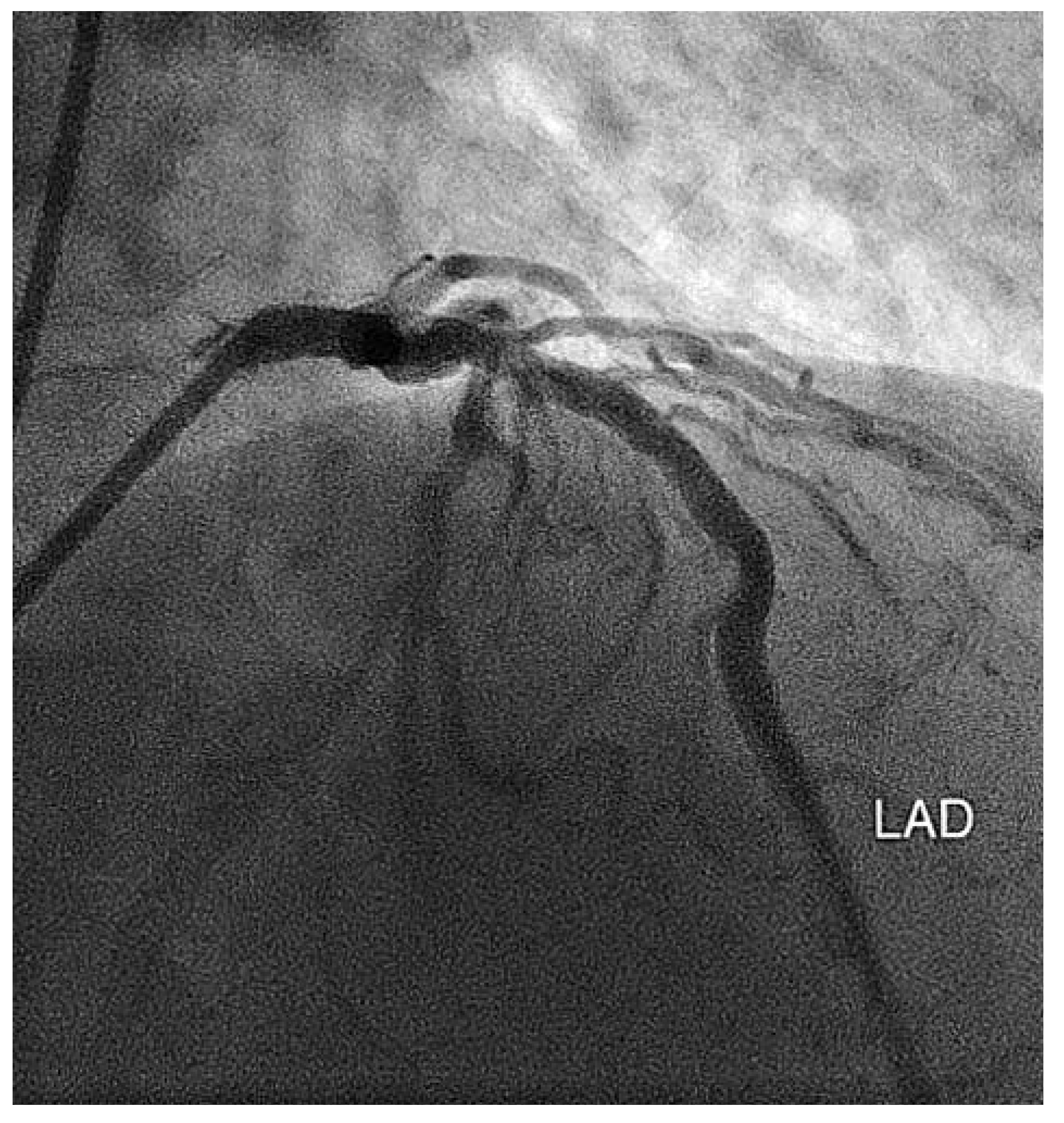 Cardiovascmed 11 00326 g006 Cardiovascmed 11 00326 g006