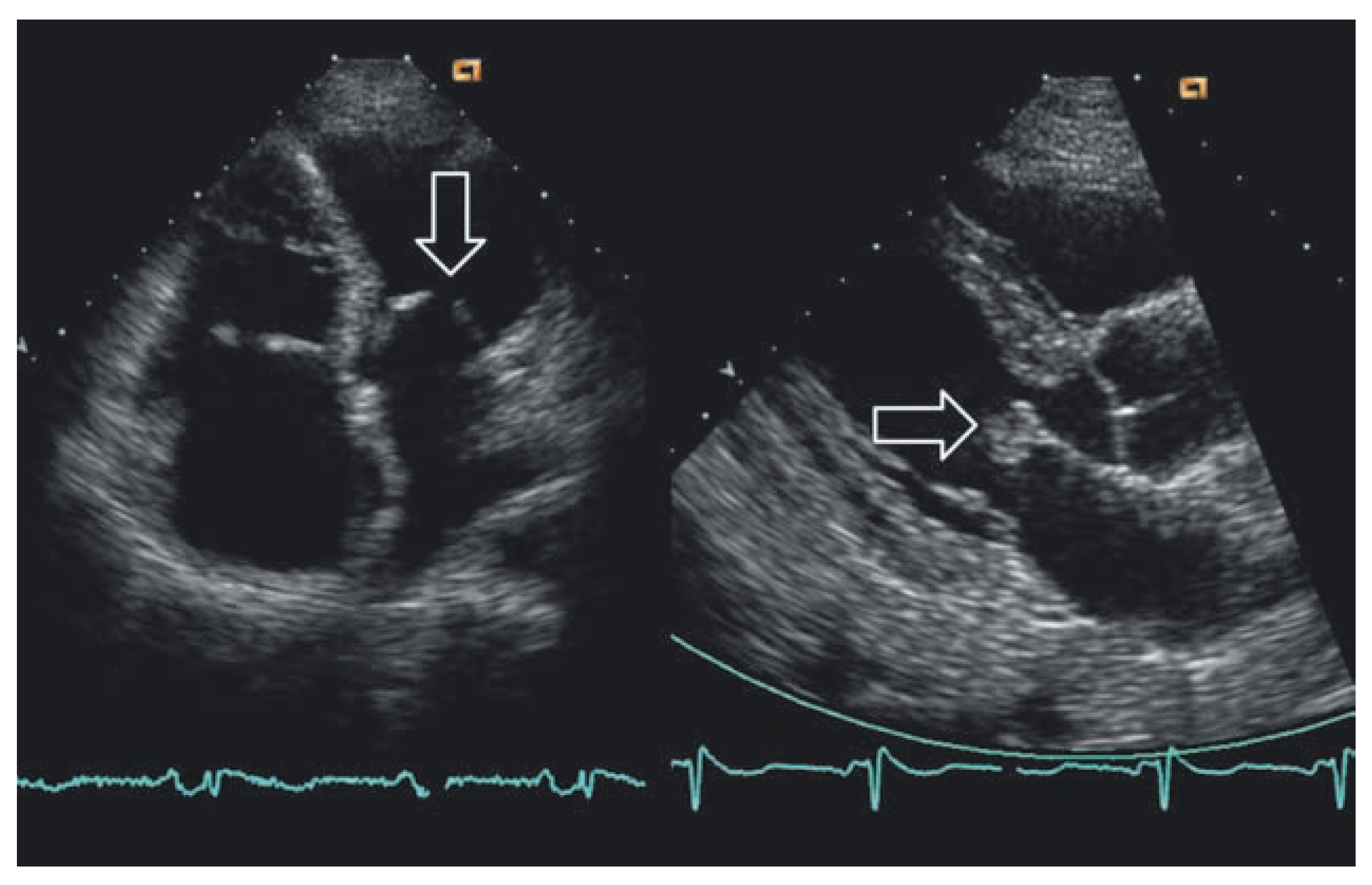 Cardiovascmed 11 00373 g002
