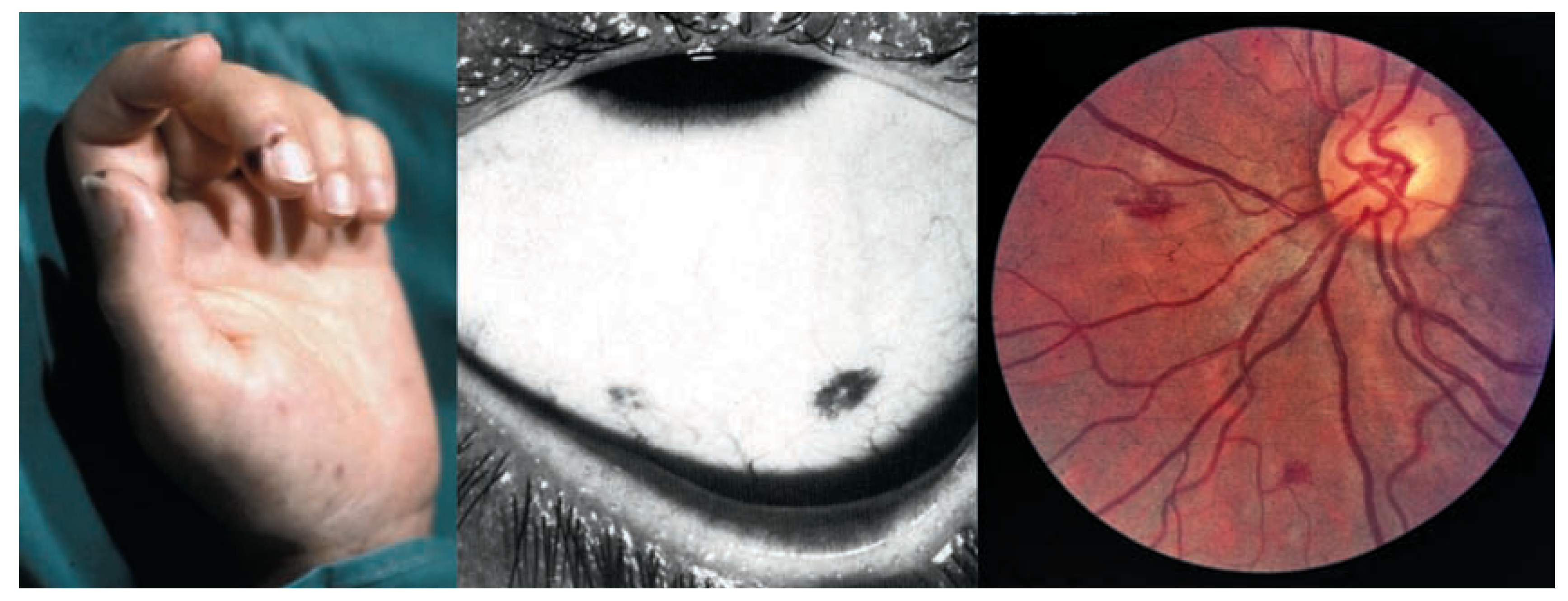 Cardiovascmed 11 00373 g003