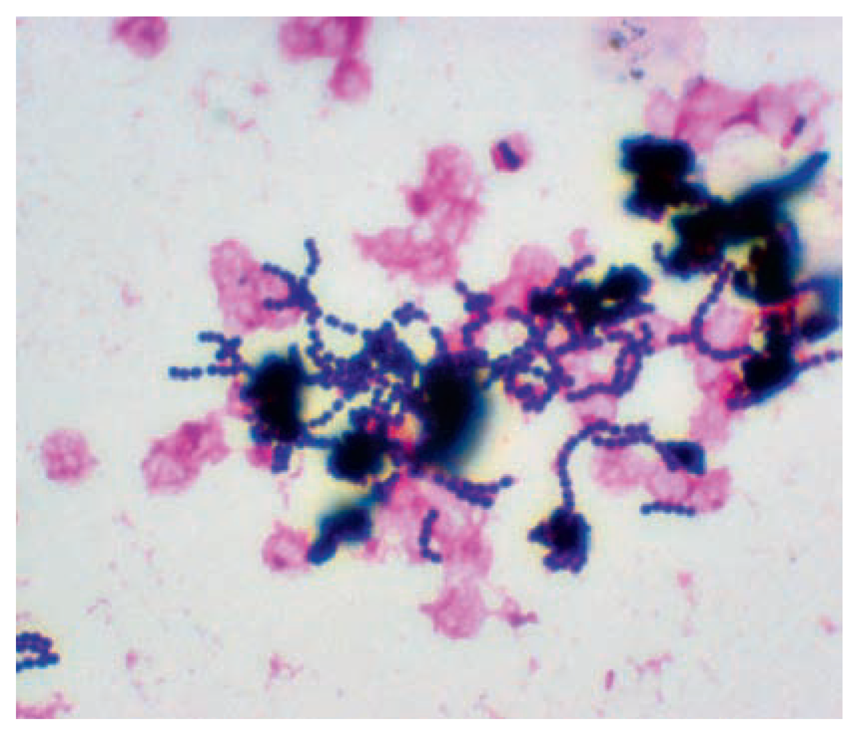 Cardiovascmed 11 00373 g004