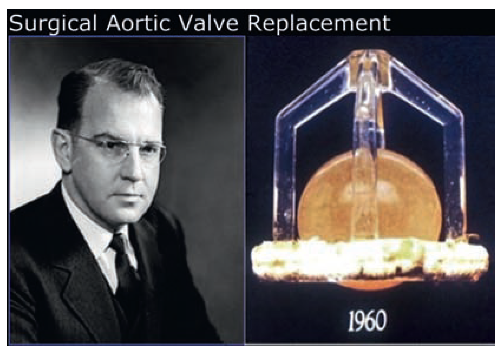 Cardiovascmed 11 00373 g006