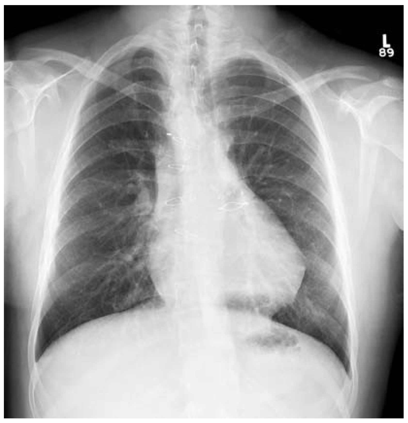 Cardiovascmed 11 00379 g001