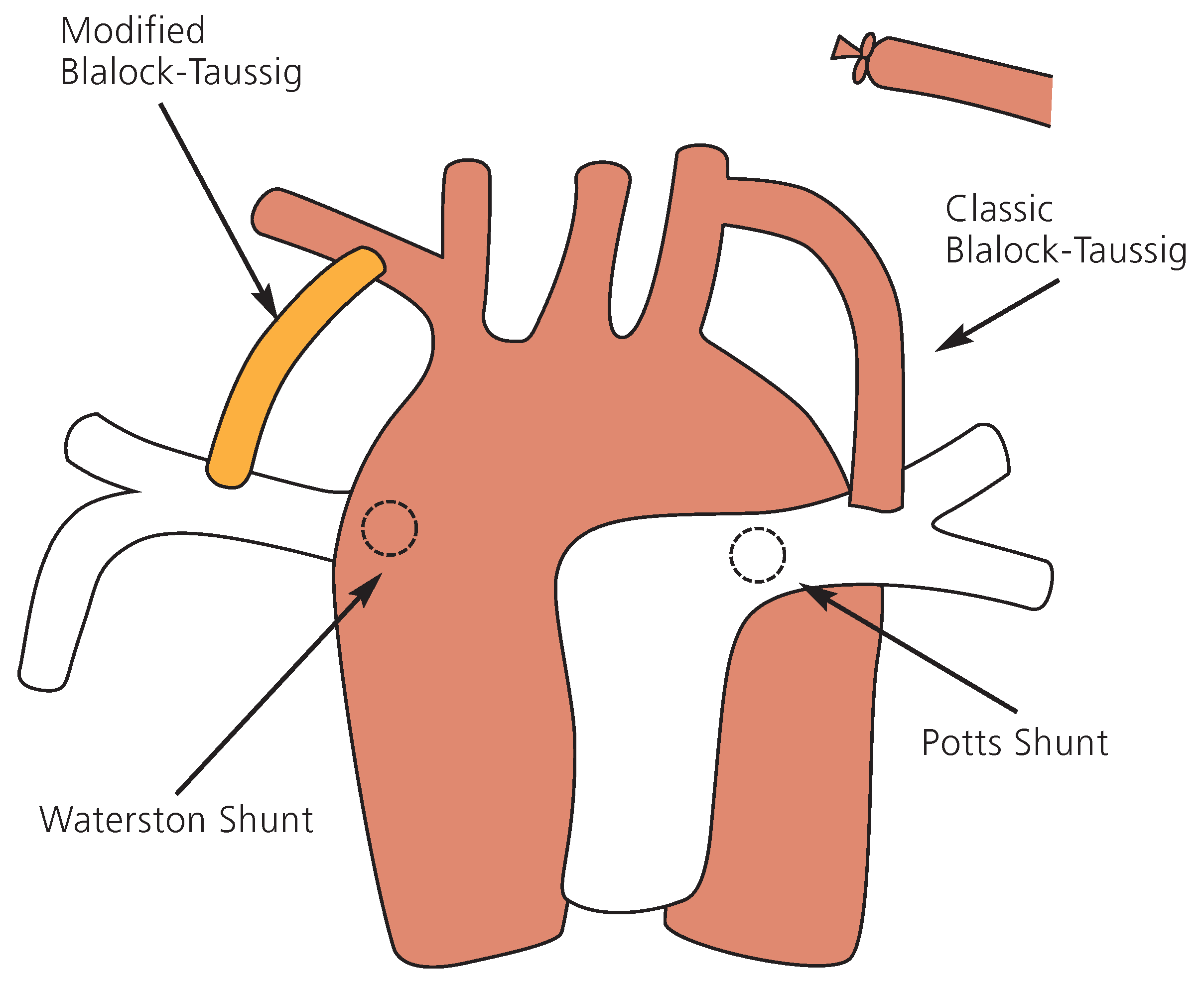 Cardiovascmed 11 00379 g003