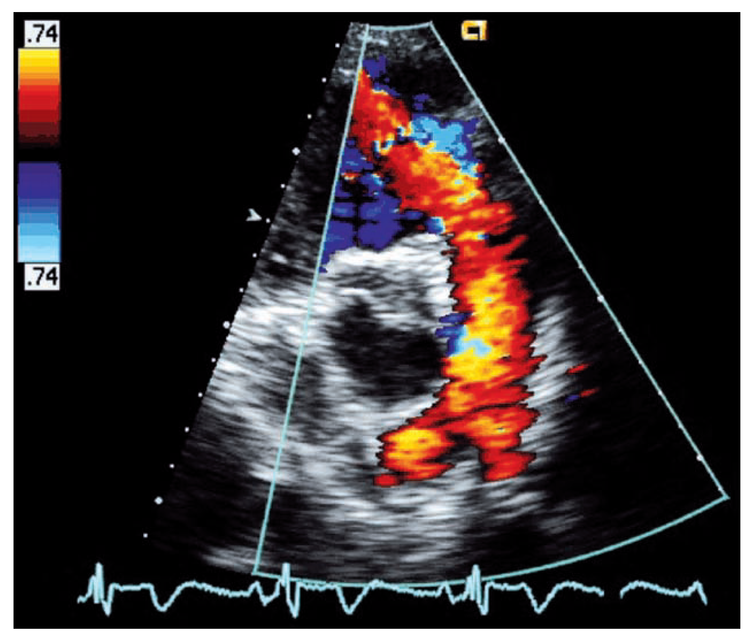 Cardiovascmed 11 00379 g005