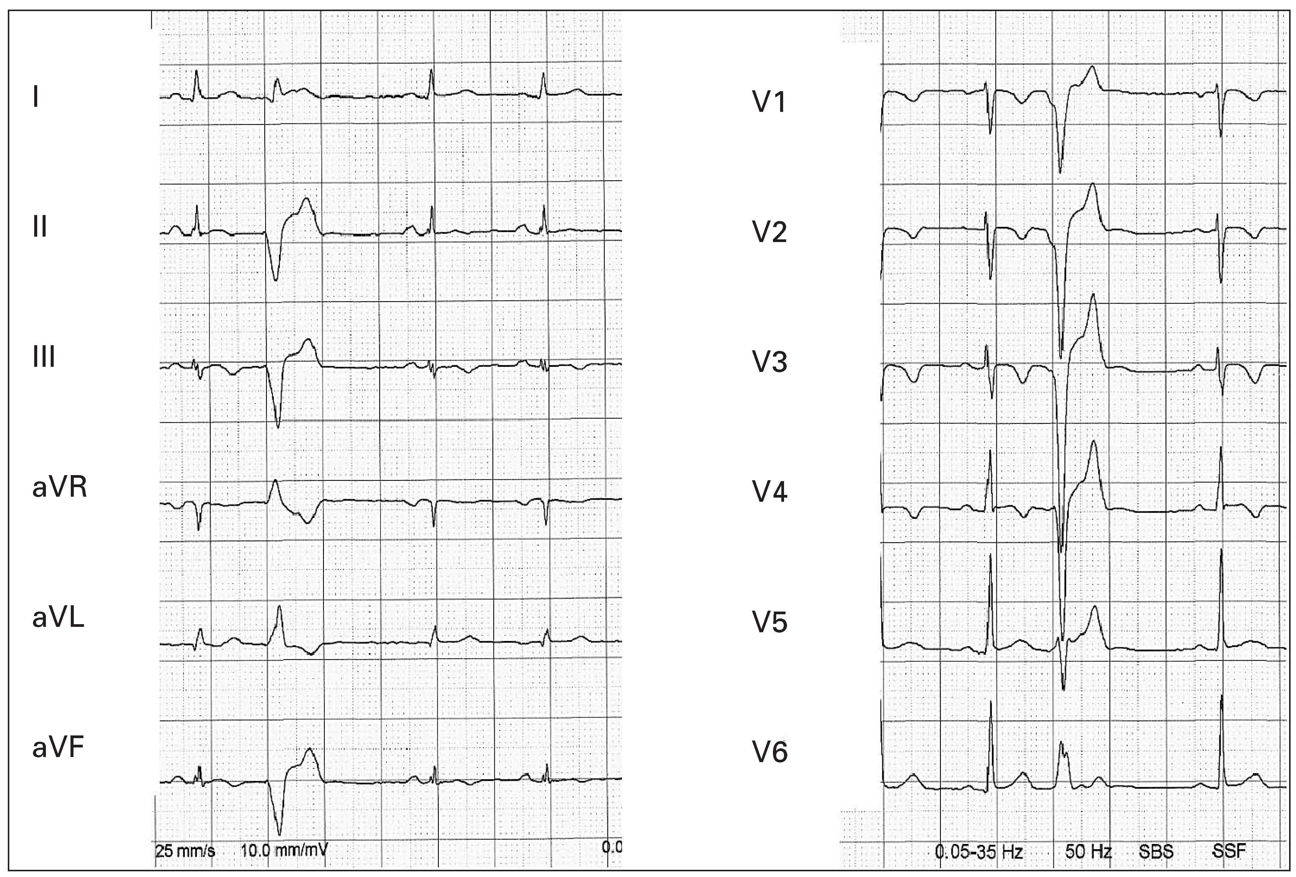 Cardiovascmed 11 00387 g001 Cardiovascmed 11 00387 g001