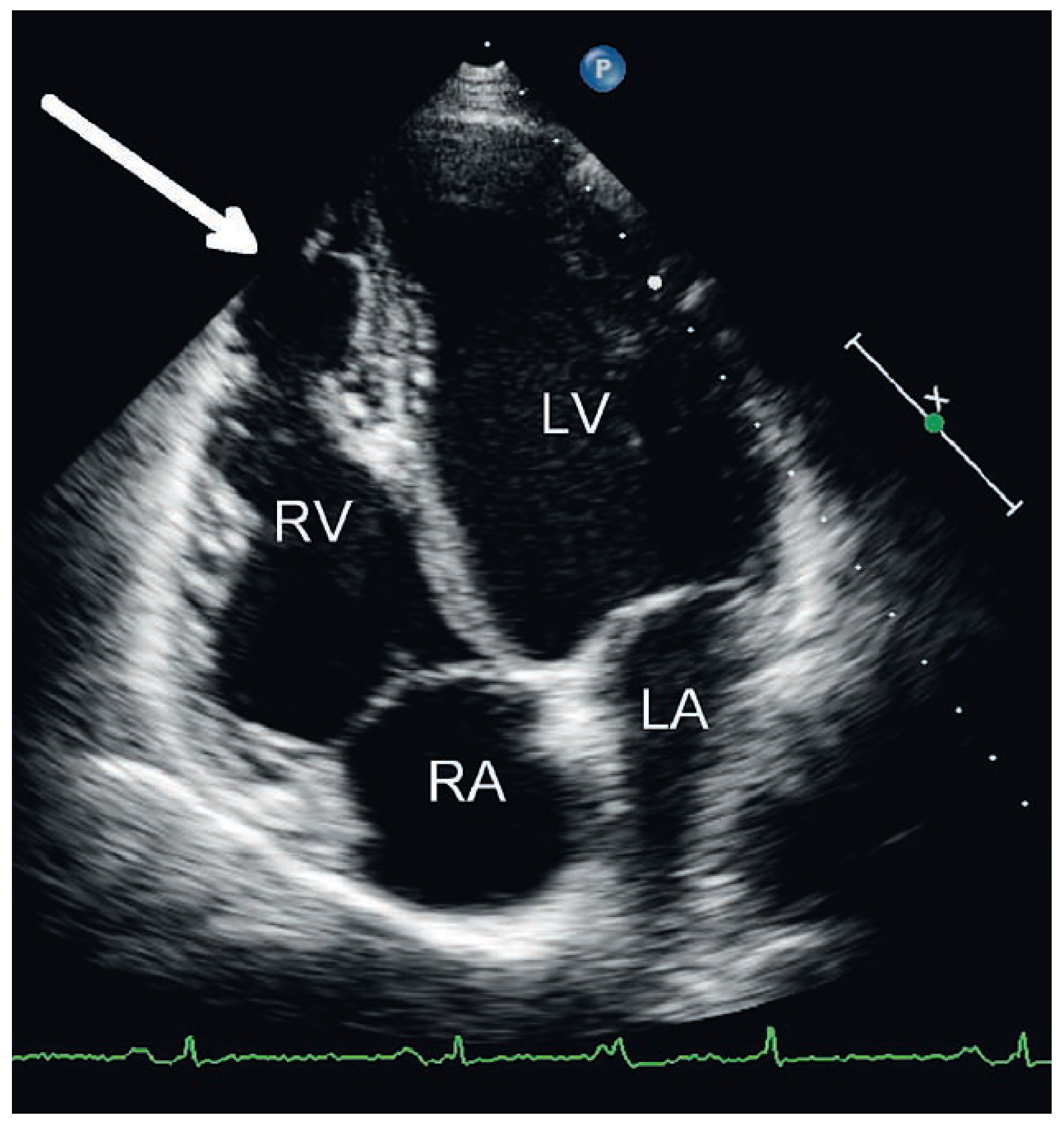 Cardiovascmed 11 00387 g002 Cardiovascmed 11 00387 g002
