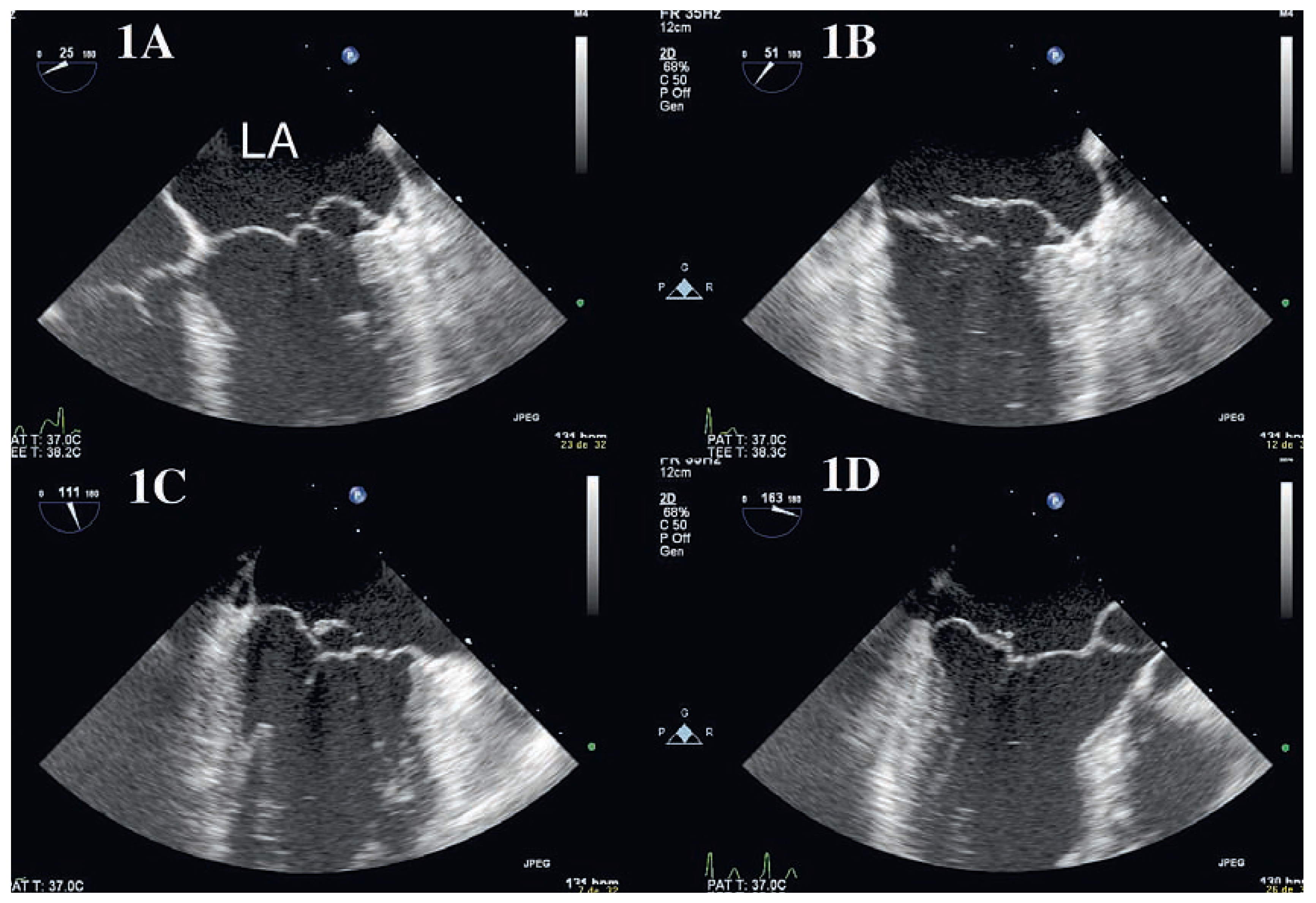 Cardiovascmed 11 00390 g001