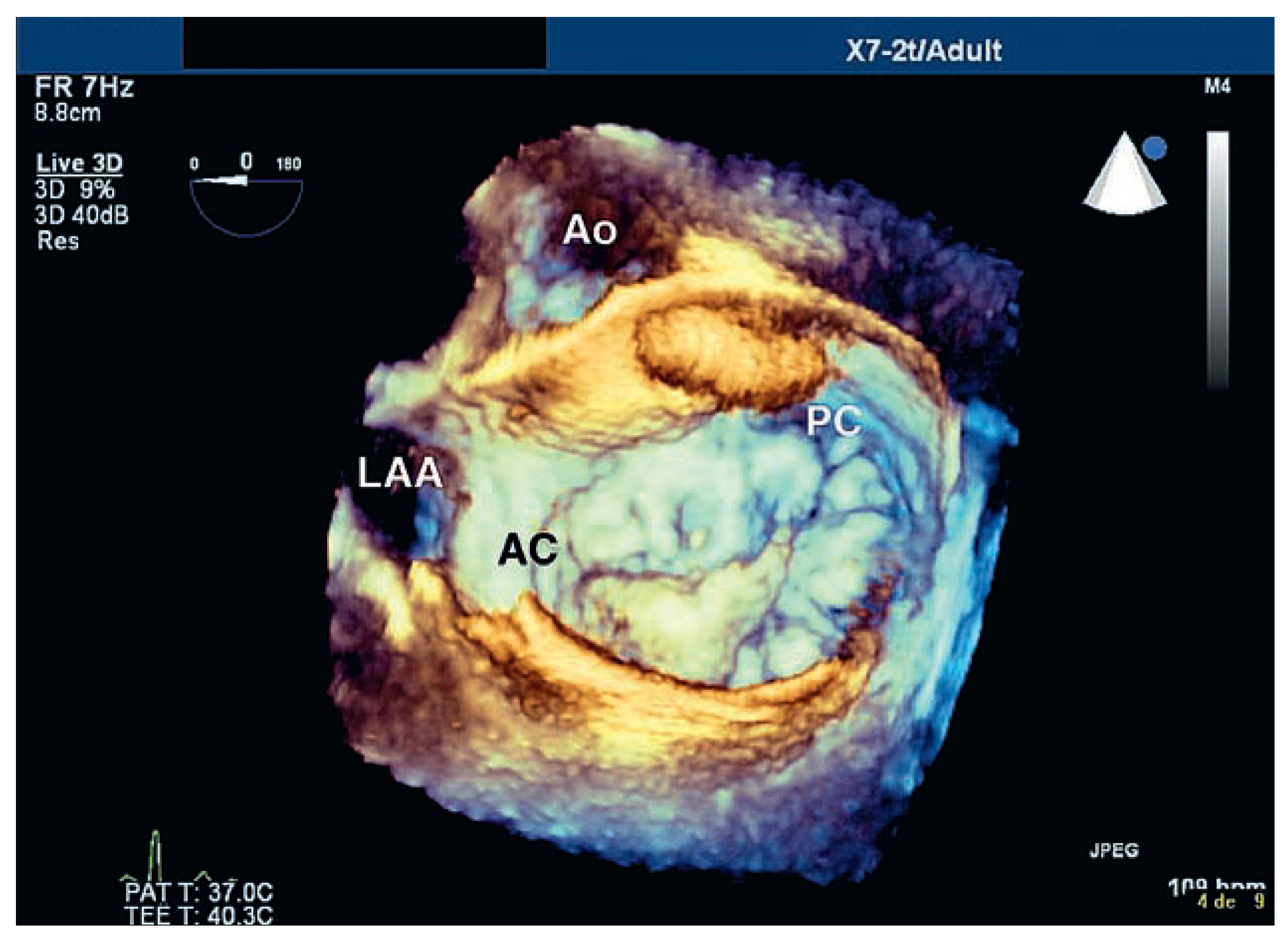 Cardiovascmed 11 00390 g002