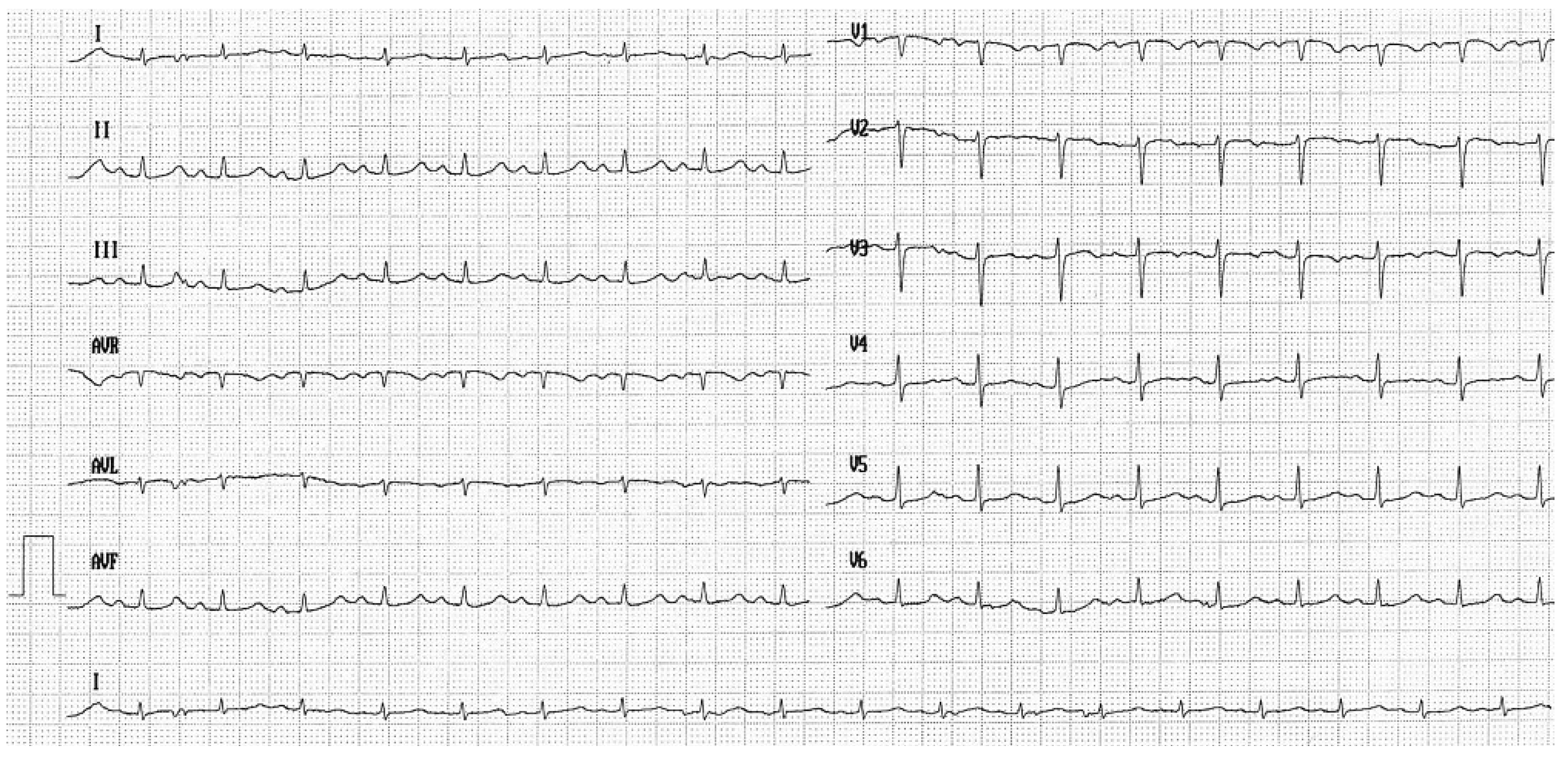 Cardiovascmed 12 00017 g003 Cardiovascmed 12 00017 g003