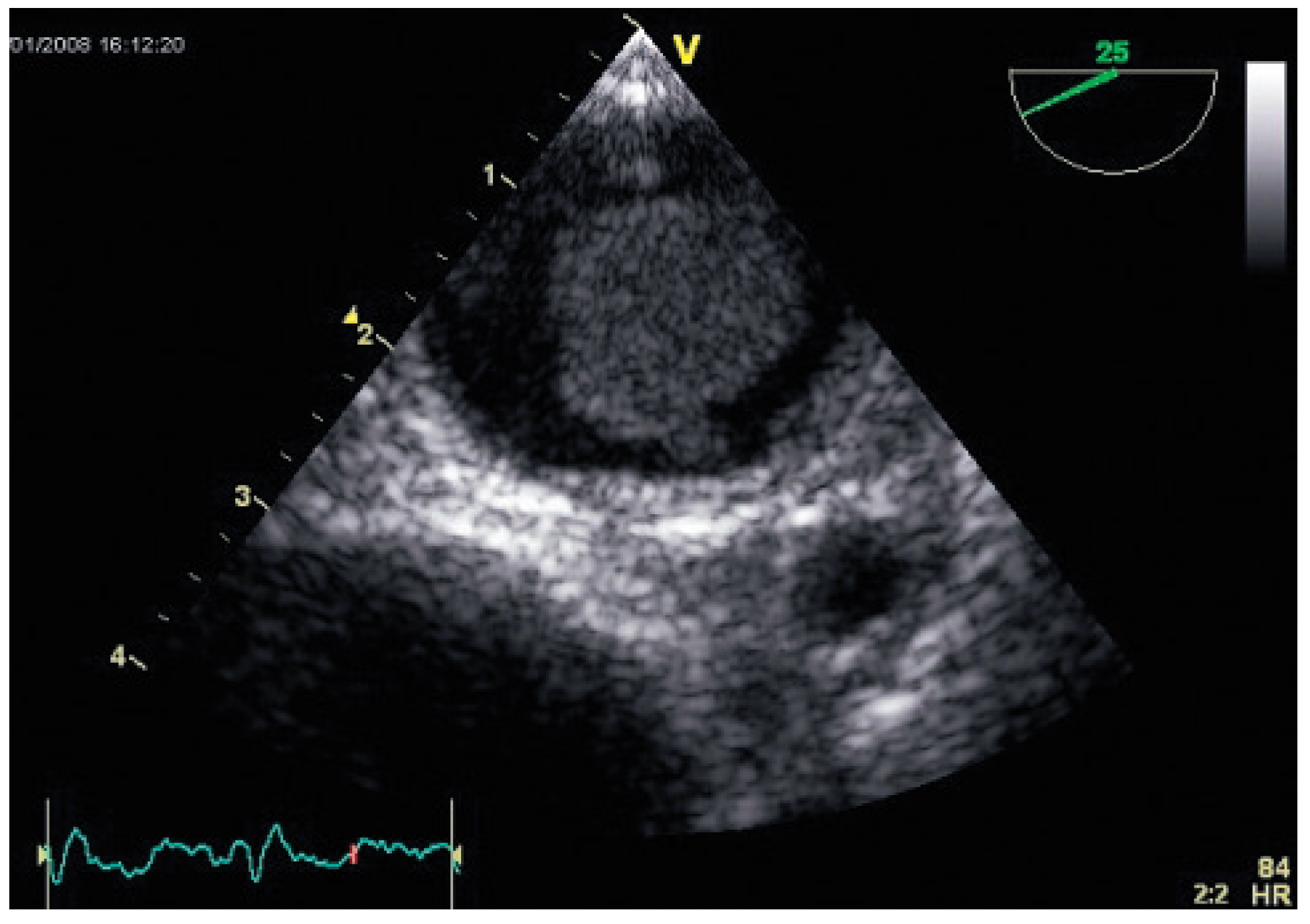 Cardiovascmed 12 00020 g001