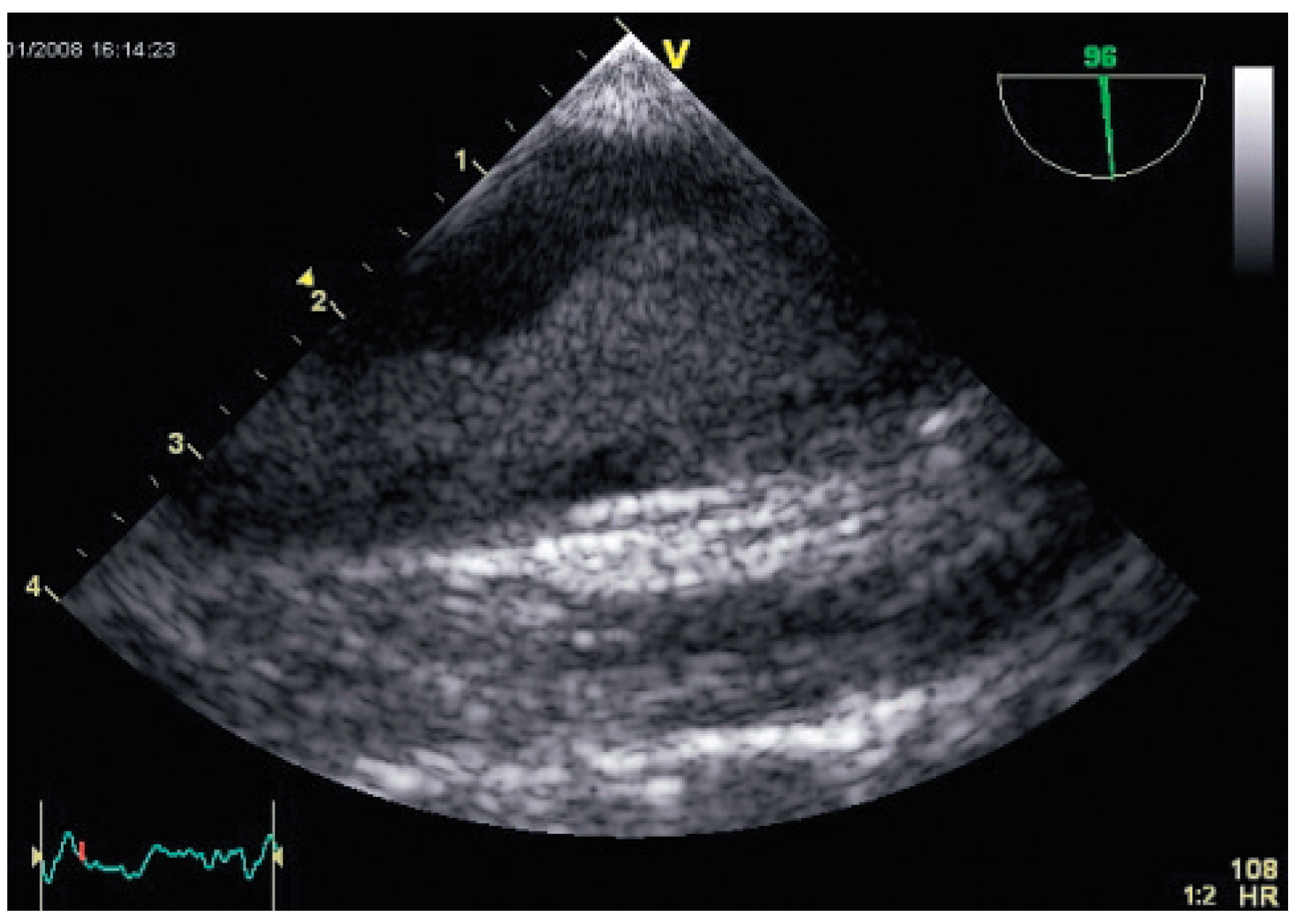 Cardiovascmed 12 00020 g002