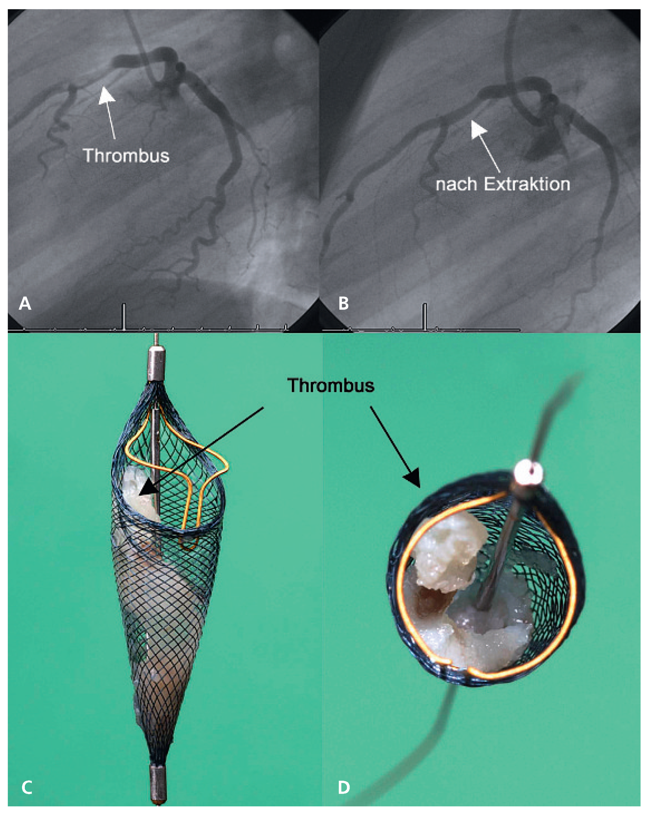 Cardiovascmed 12 00045 g002 Cardiovascmed 12 00045 g002