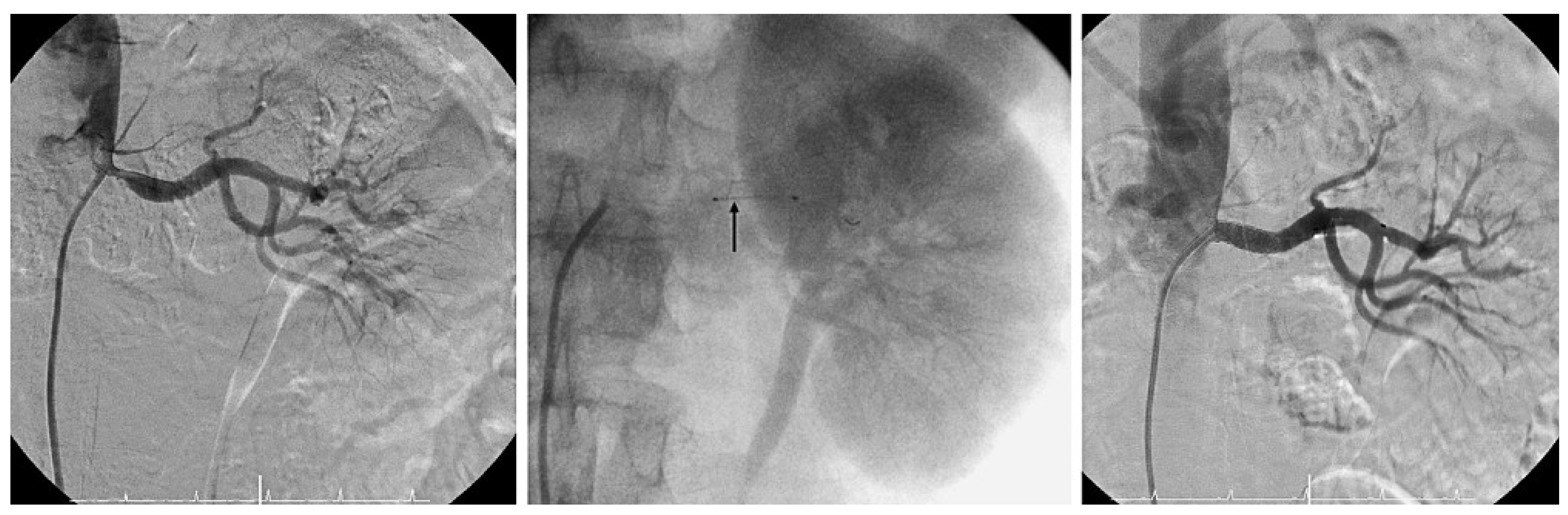 Cardiovascmed 12 00045 g006 Cardiovascmed 12 00045 g006