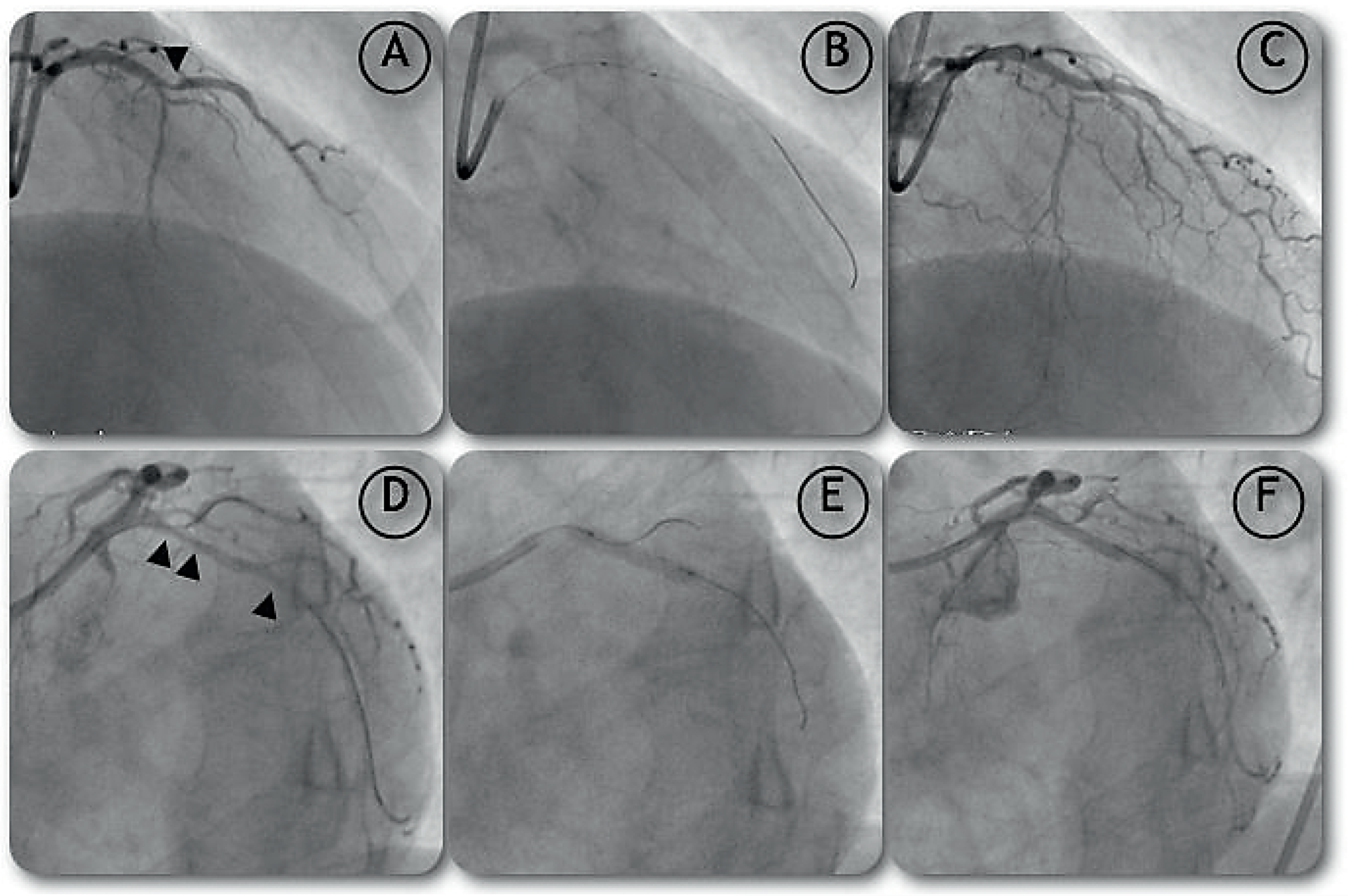 Cardiovascmed 12 00053 g001