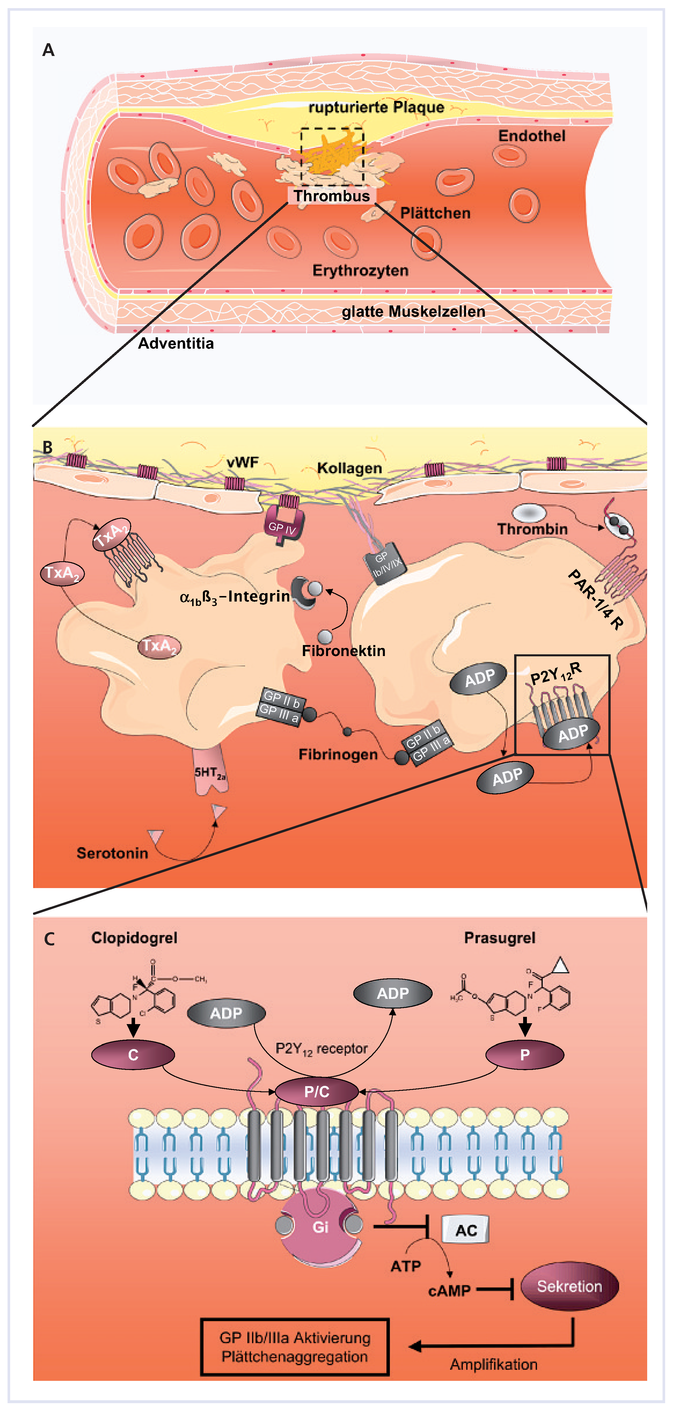 Cardiovascmed 12 00078 g001