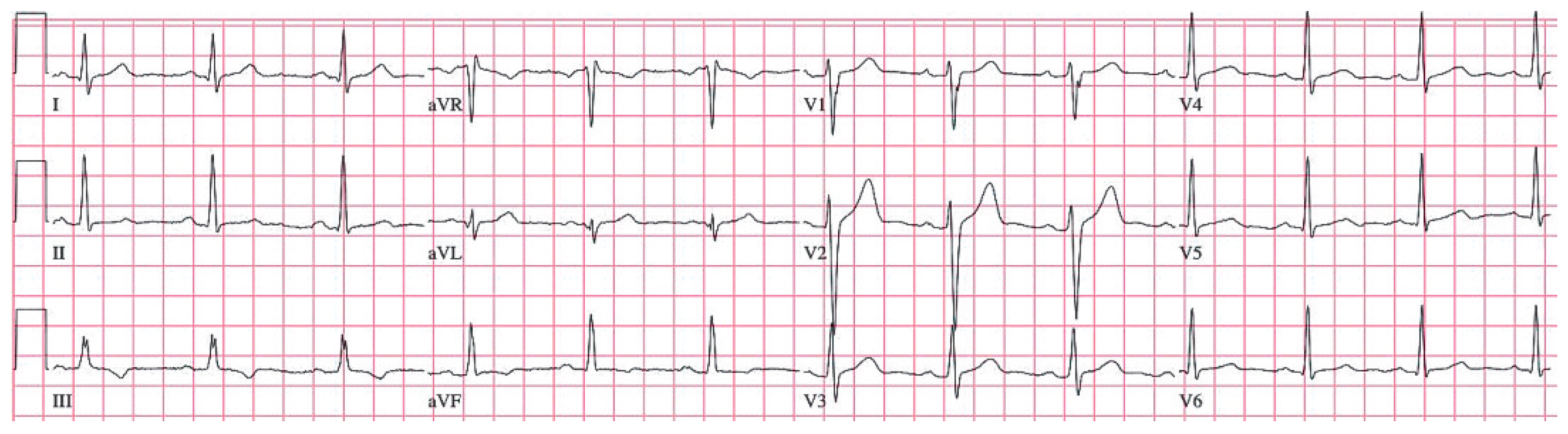 Cardiovascmed 12 00094 g001 Cardiovascmed 12 00094 g001