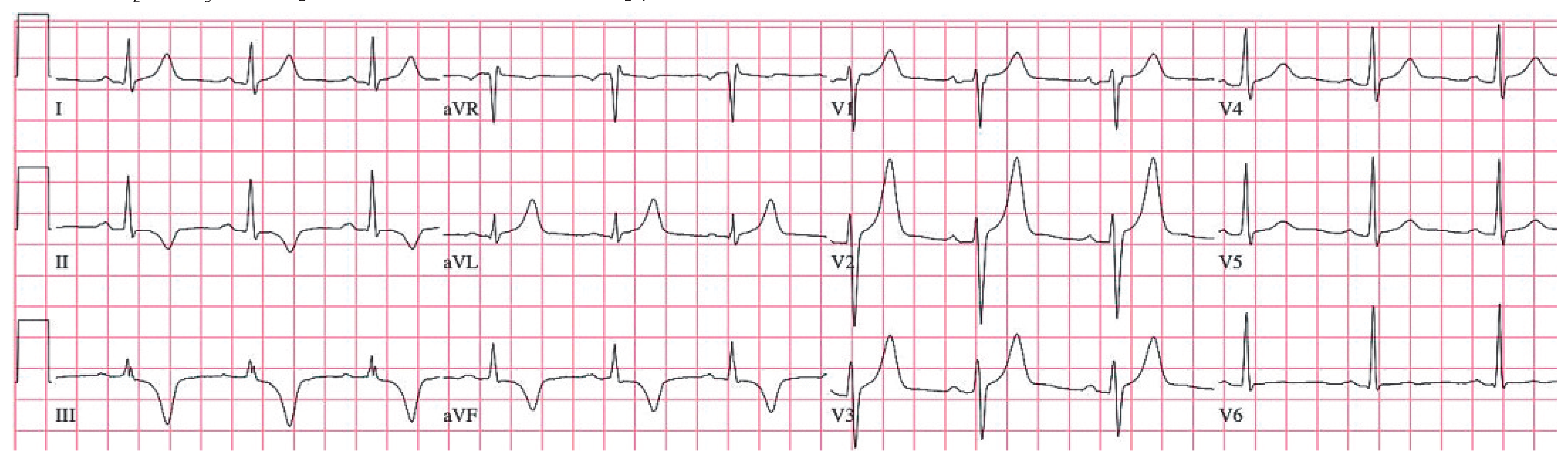 Cardiovascmed 12 00094 g002 Cardiovascmed 12 00094 g002
