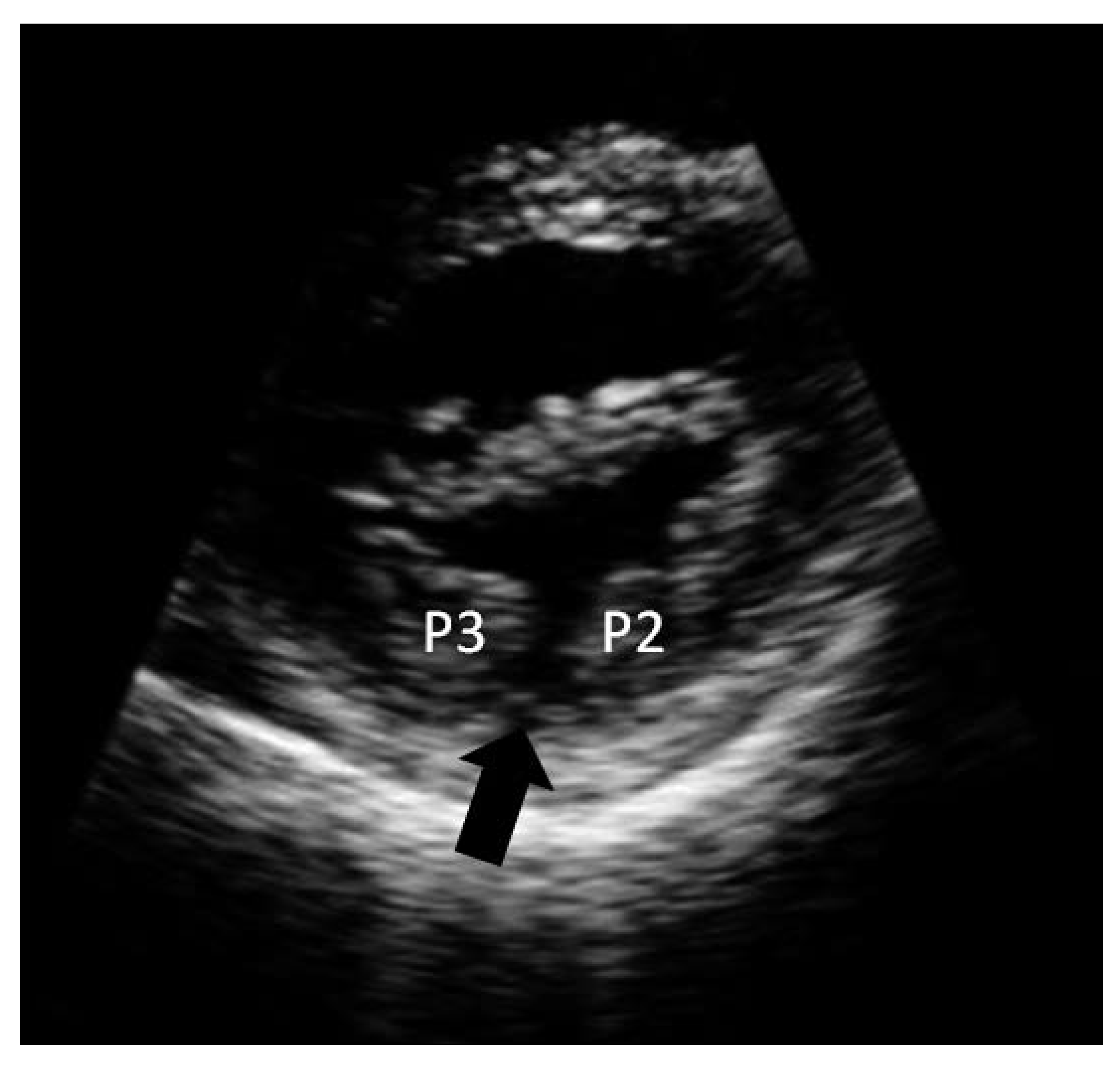 Cardiovascmed 12 00096 g001 Cardiovascmed 12 00096 g001