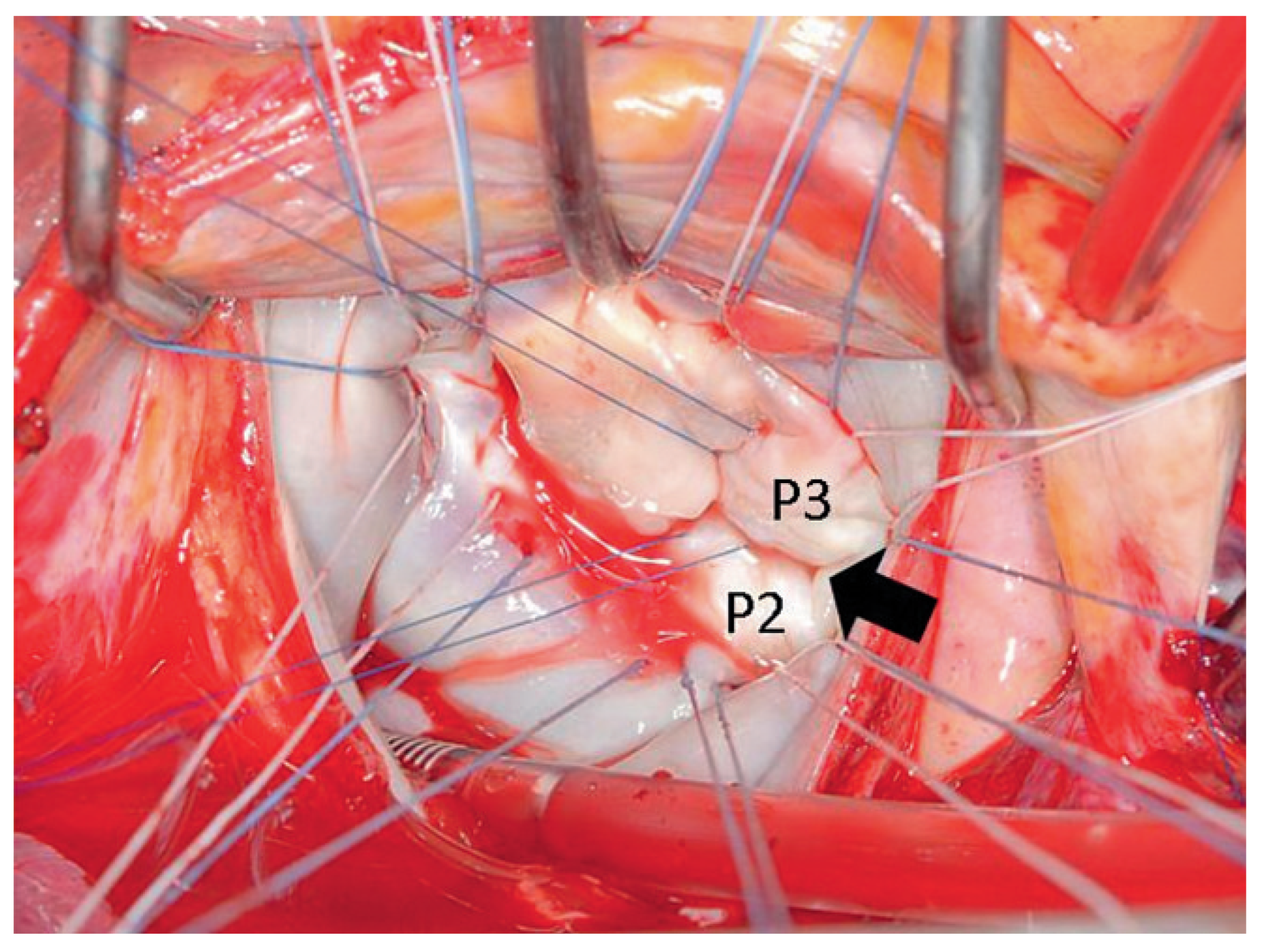 Cardiovascmed 12 00096 g002 Cardiovascmed 12 00096 g002