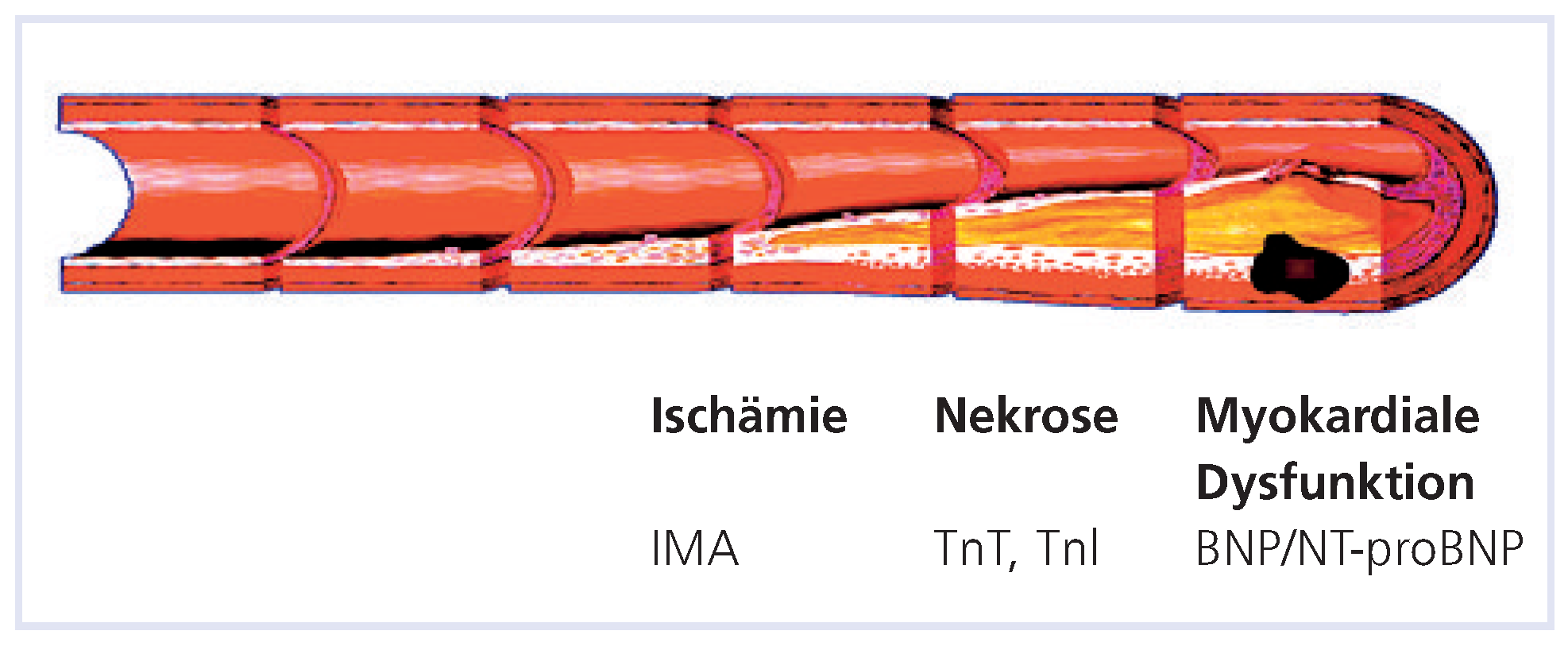 Cardiovascmed 12 00109 g001