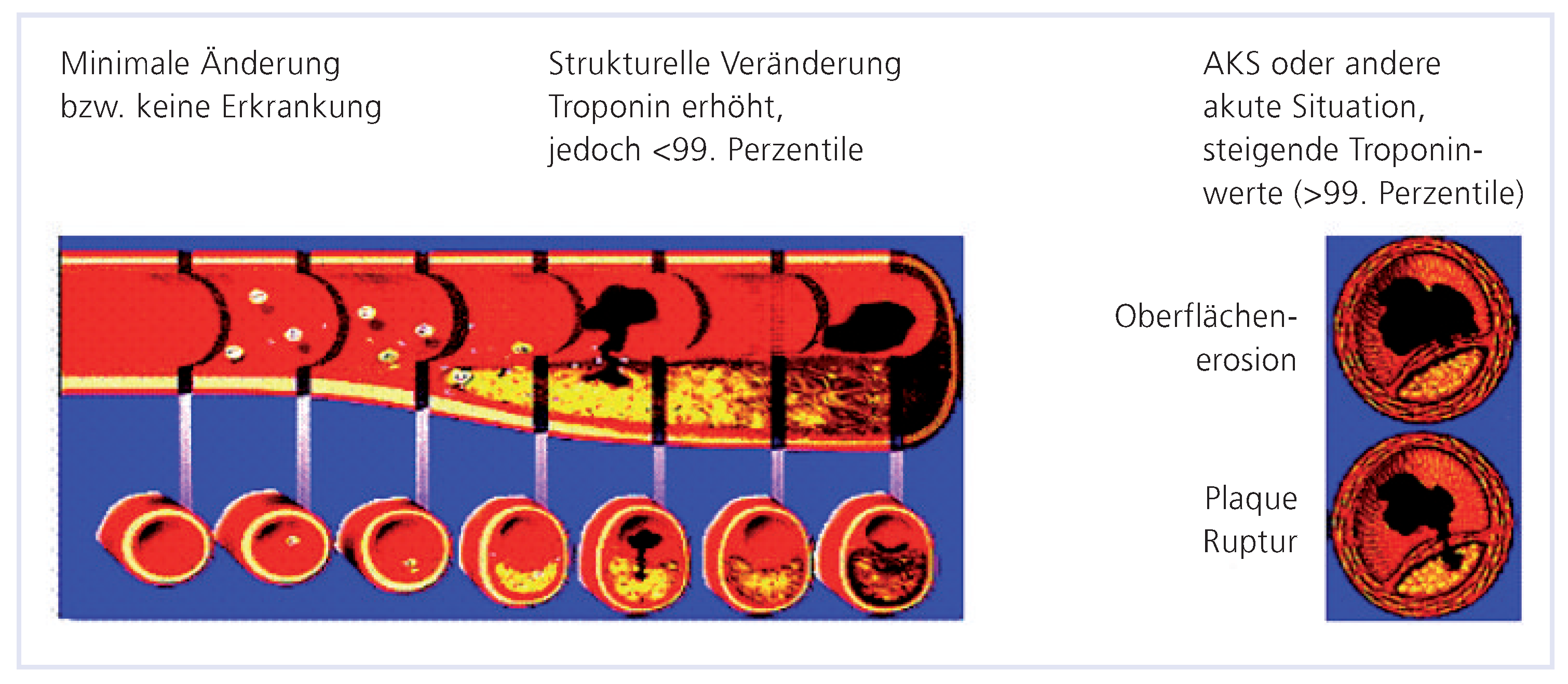 Cardiovascmed 12 00109 g003