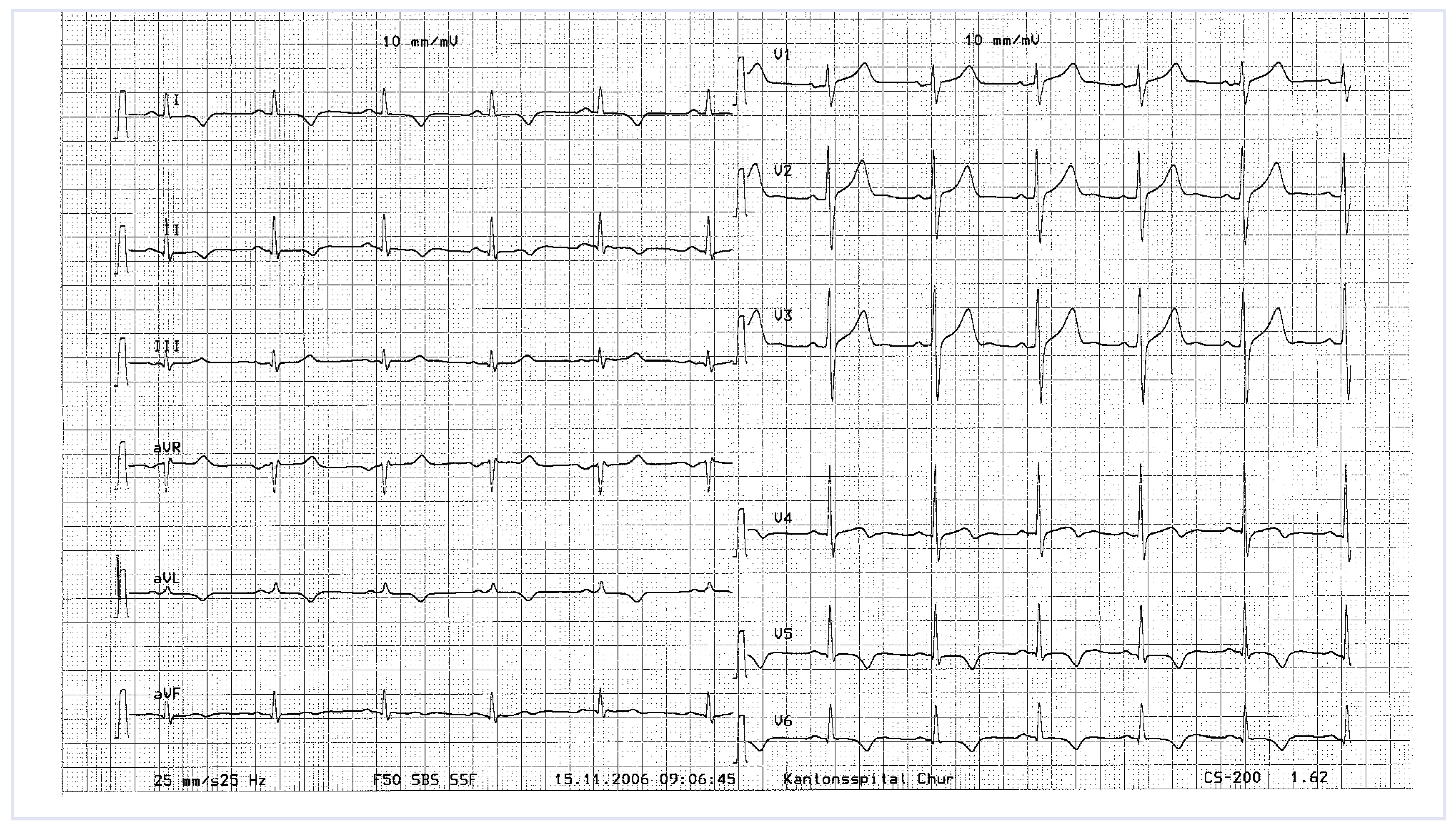 Cardiovascmed 12 00129 g003 Cardiovascmed 12 00129 g003