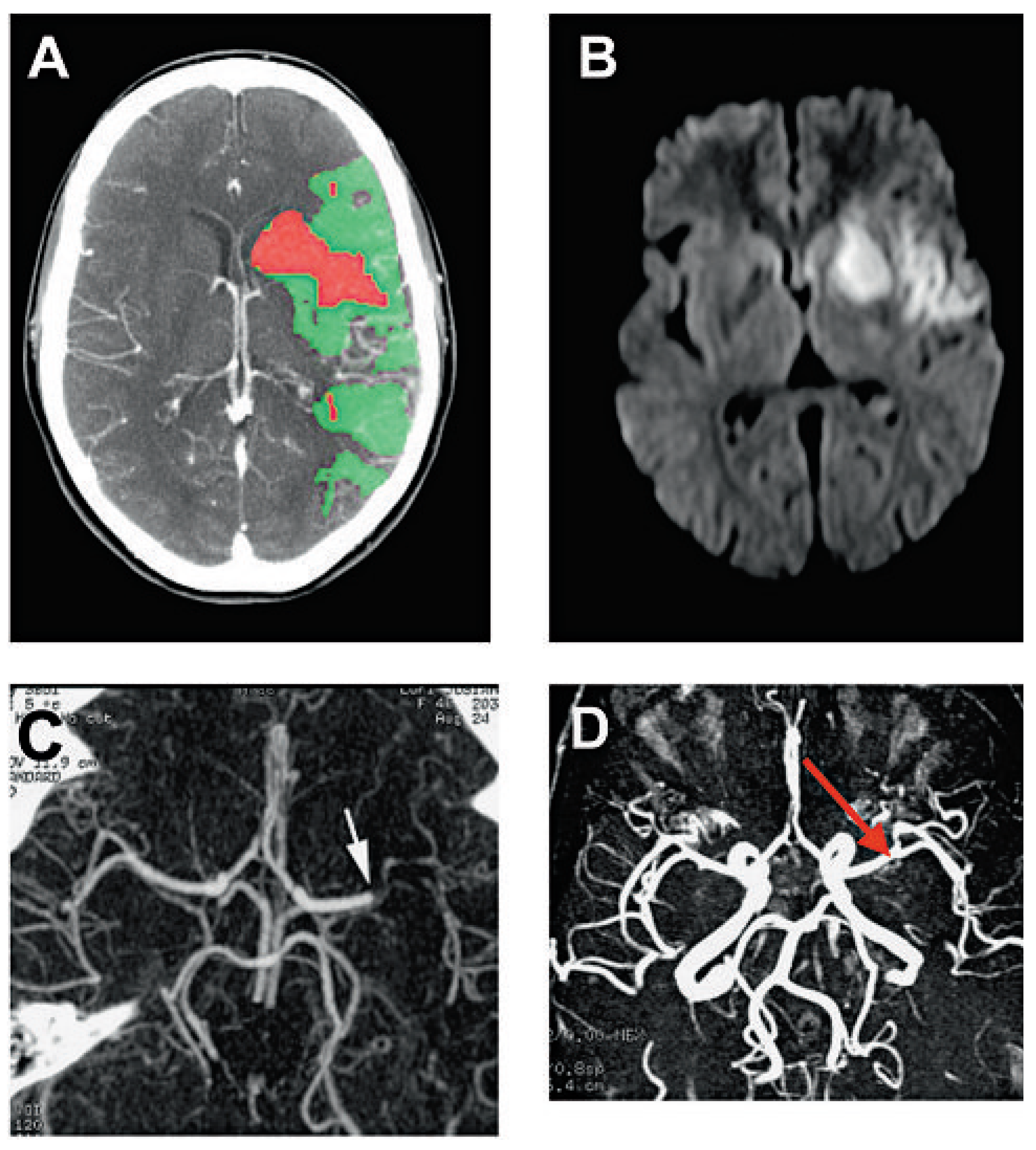 Cardiovascmed 12 00143 g001