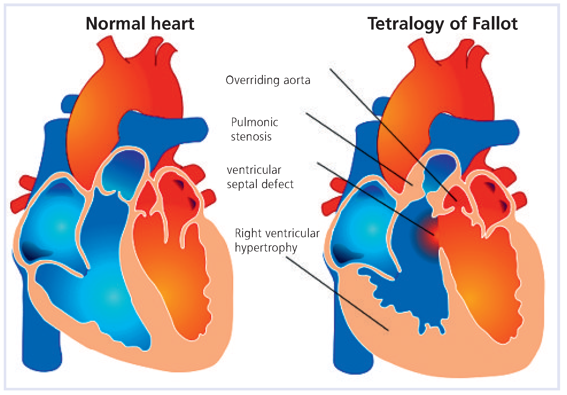 Cardiovascmed 12 00160 g002