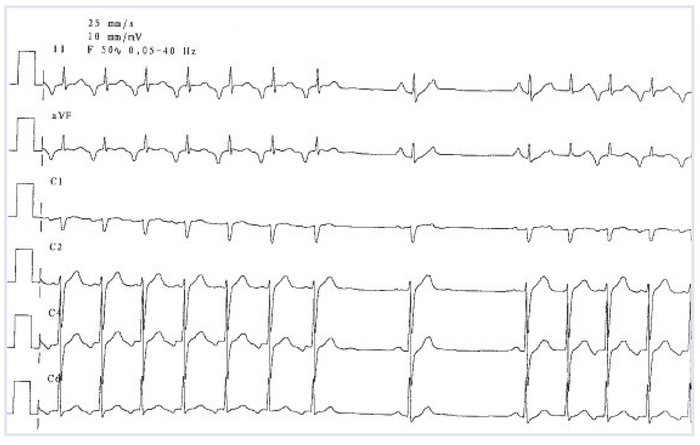 Cardiovascmed 12 00163 g001