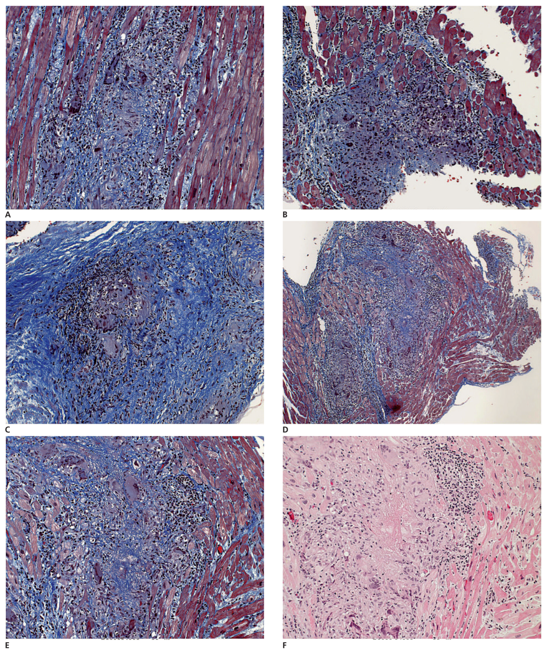 Cardiovascmed 12 00164 g004