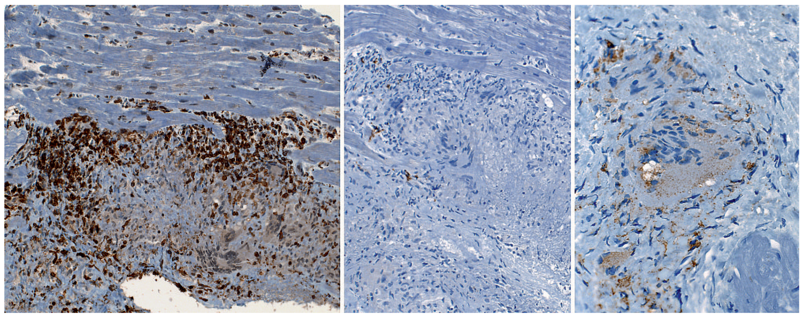 Cardiovascmed 12 00164 g005