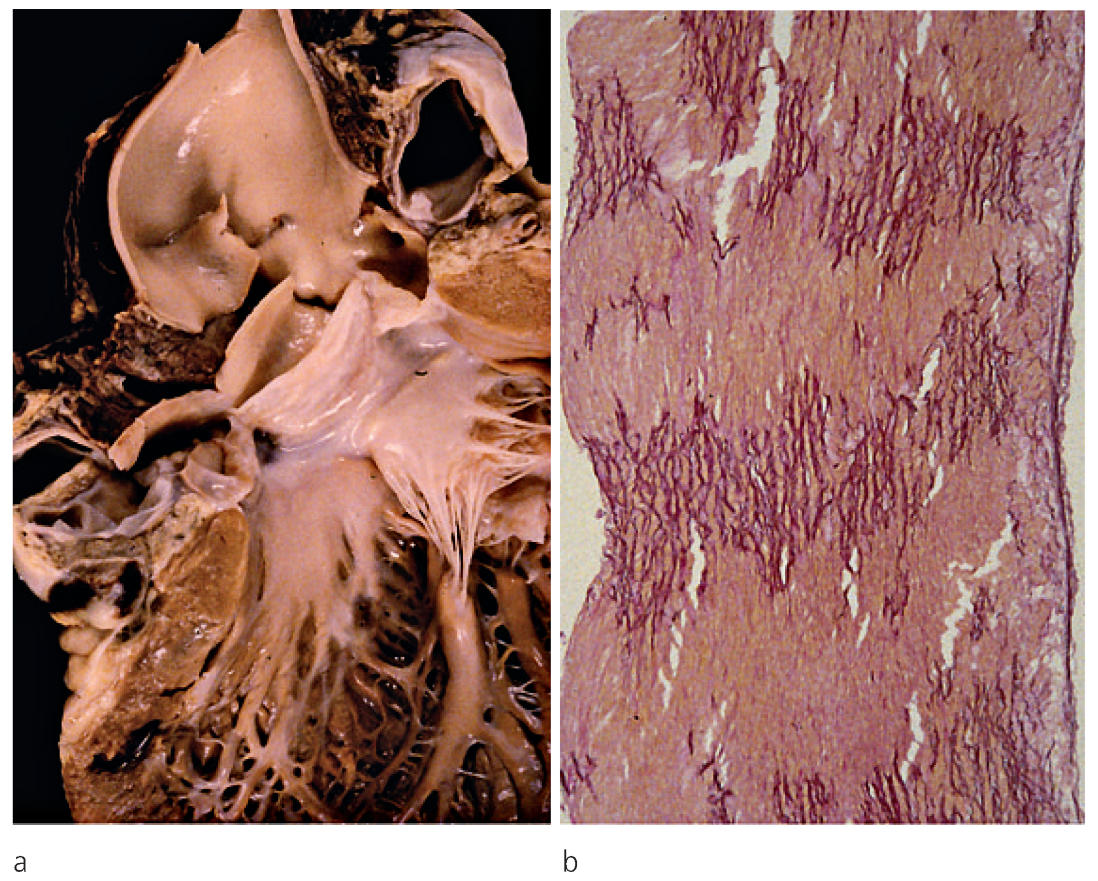 Cardiovascmed 12 00179 g001 Cardiovascmed 12 00179 g001