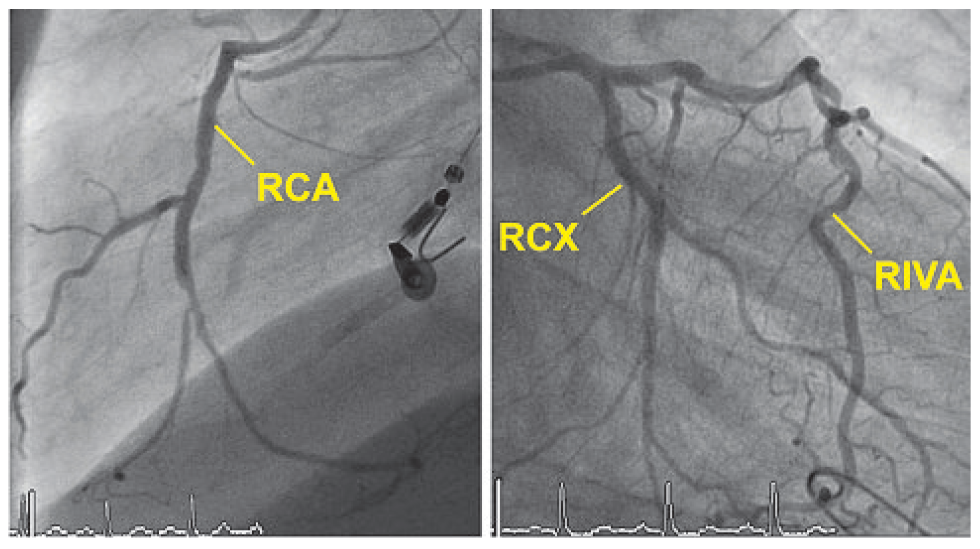 Cardiovascmed 12 00186 g002