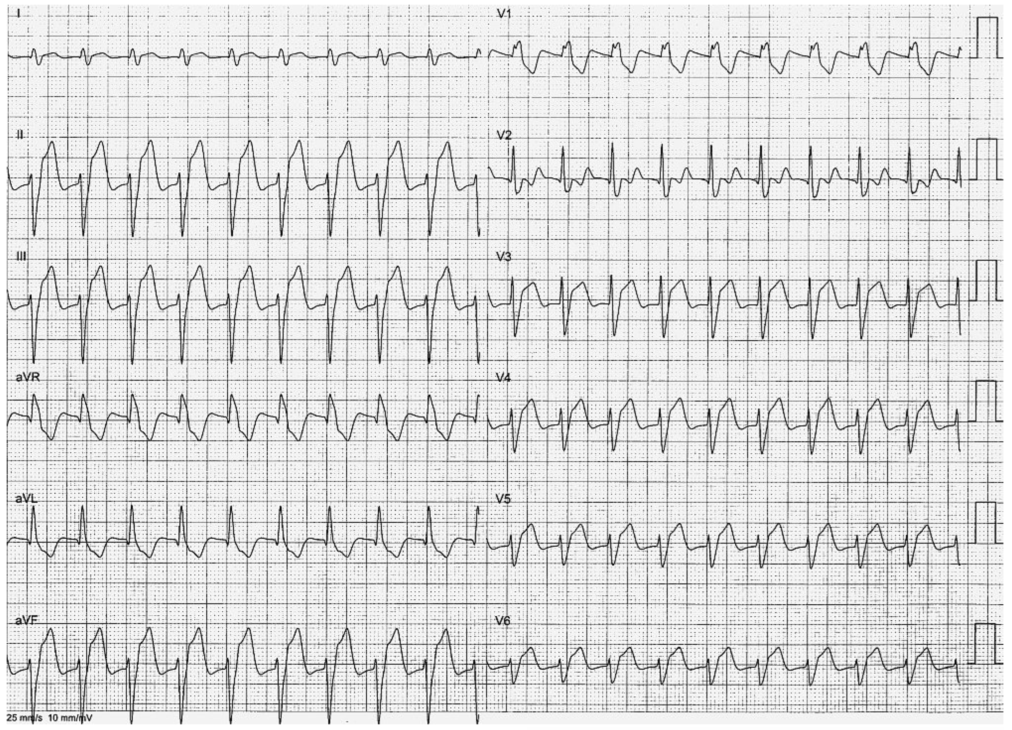 Cardiovascmed 12 00194 g001 Cardiovascmed 12 00194 g001