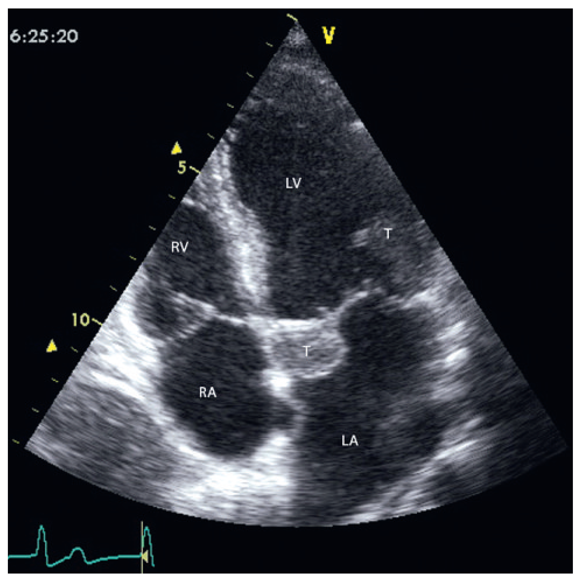 Cardiovascmed 12 00196 g002 Cardiovascmed 12 00196 g002
