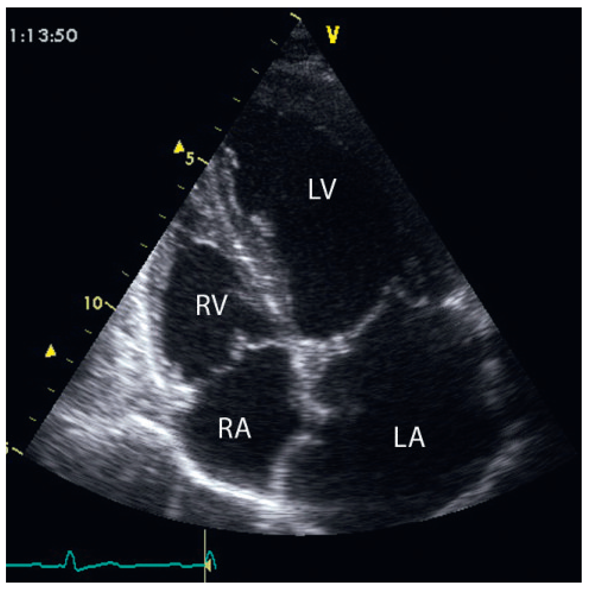 Cardiovascmed 12 00196 g003 Cardiovascmed 12 00196 g003