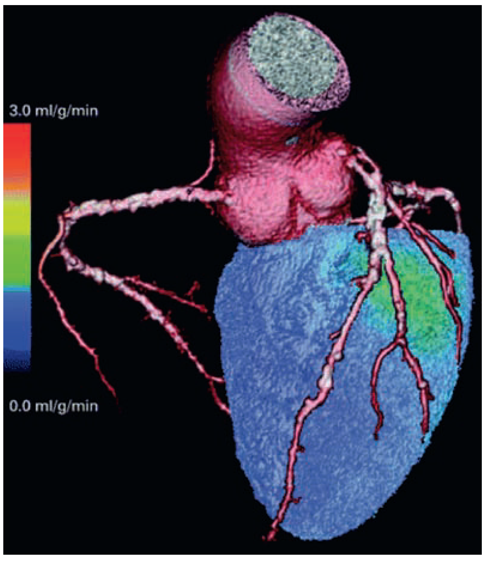 Cardiovascmed 12 00205 g001 Cardiovascmed 12 00205 g001