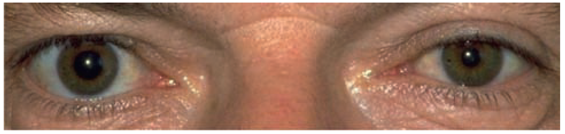 Cardiovascmed 12 00209 g002 Cardiovascmed 12 00209 g002