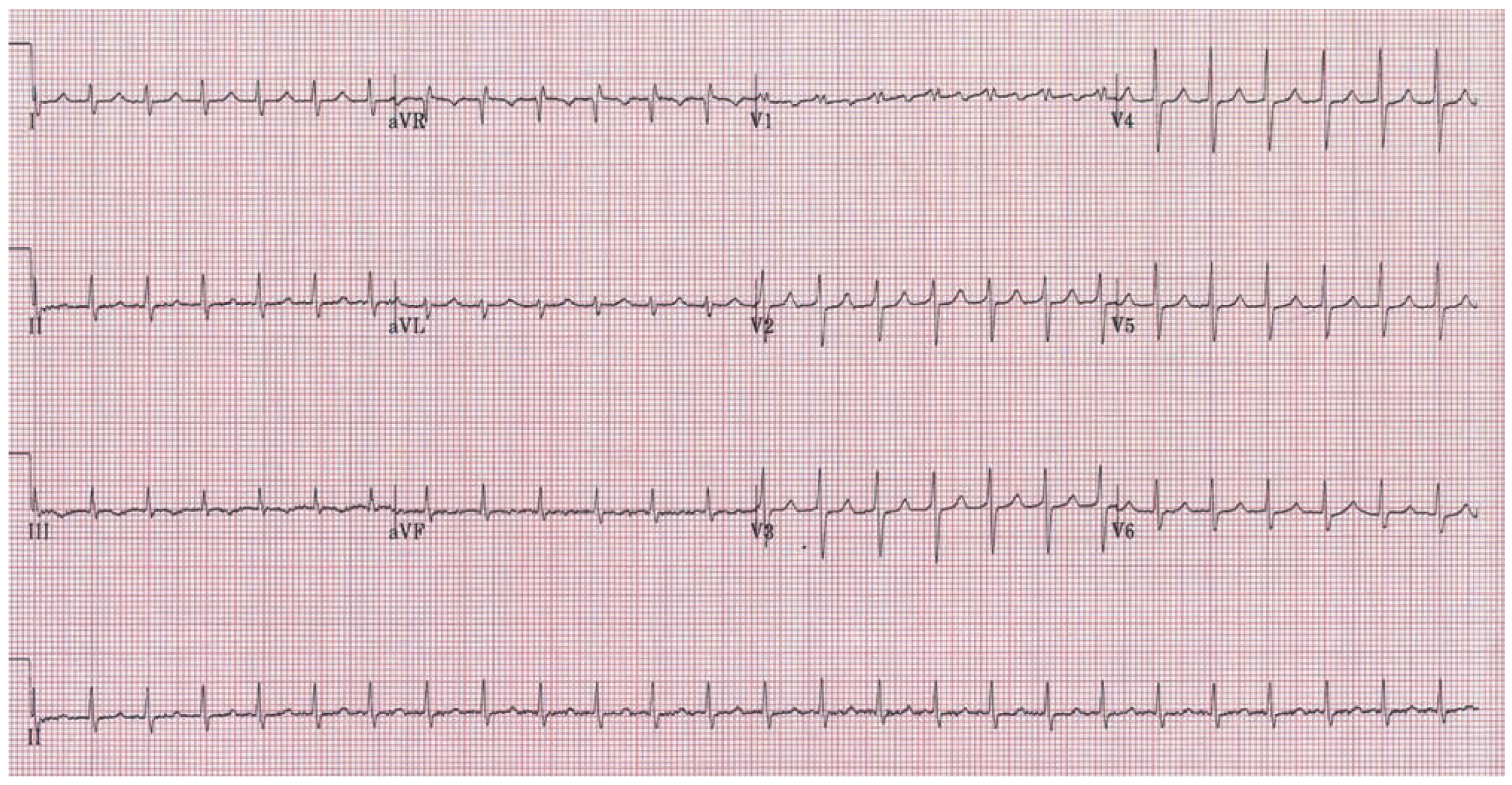 Cardiovascmed 12 00220 g001