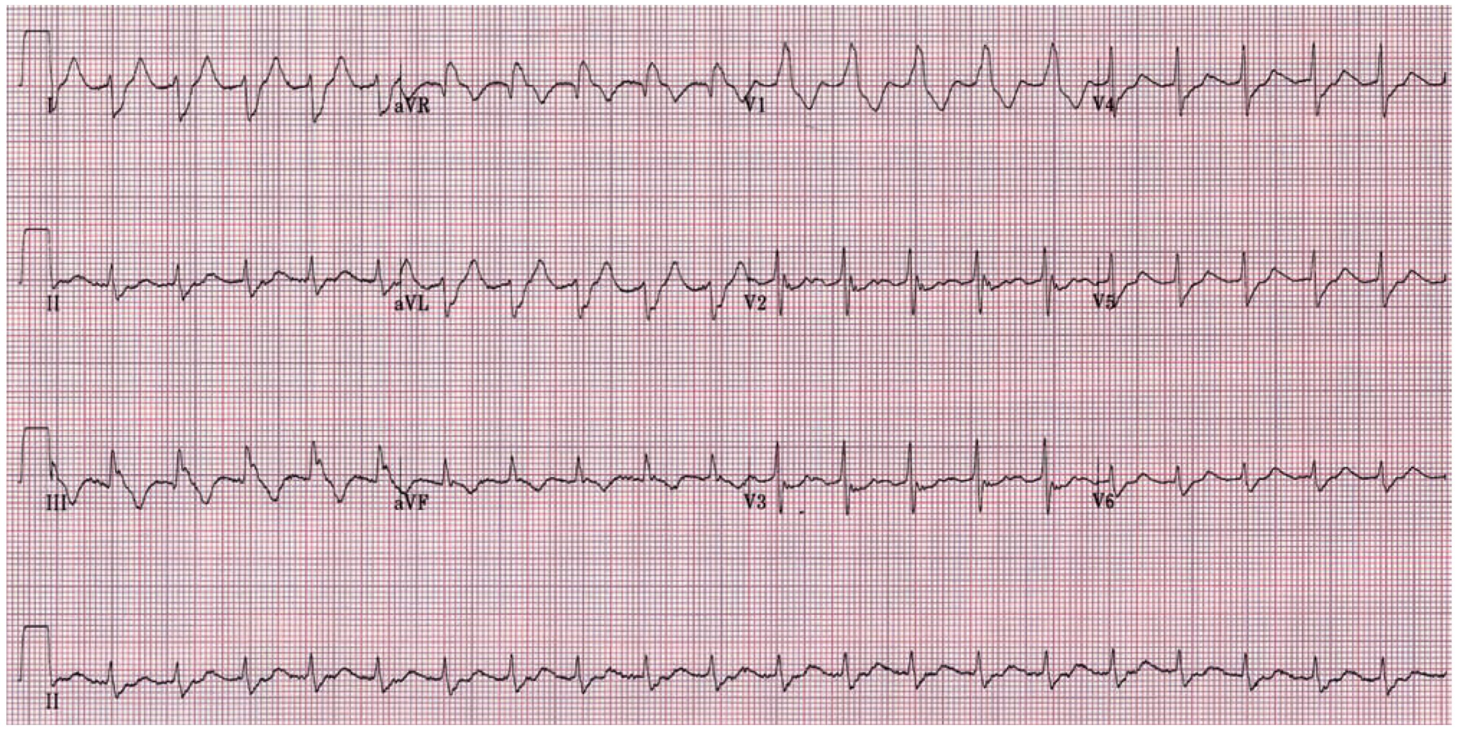 Cardiovascmed 12 00220 g002