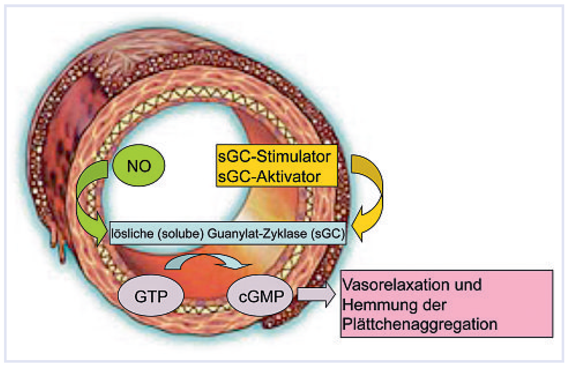 Cardiovascmed 12 00245 g001