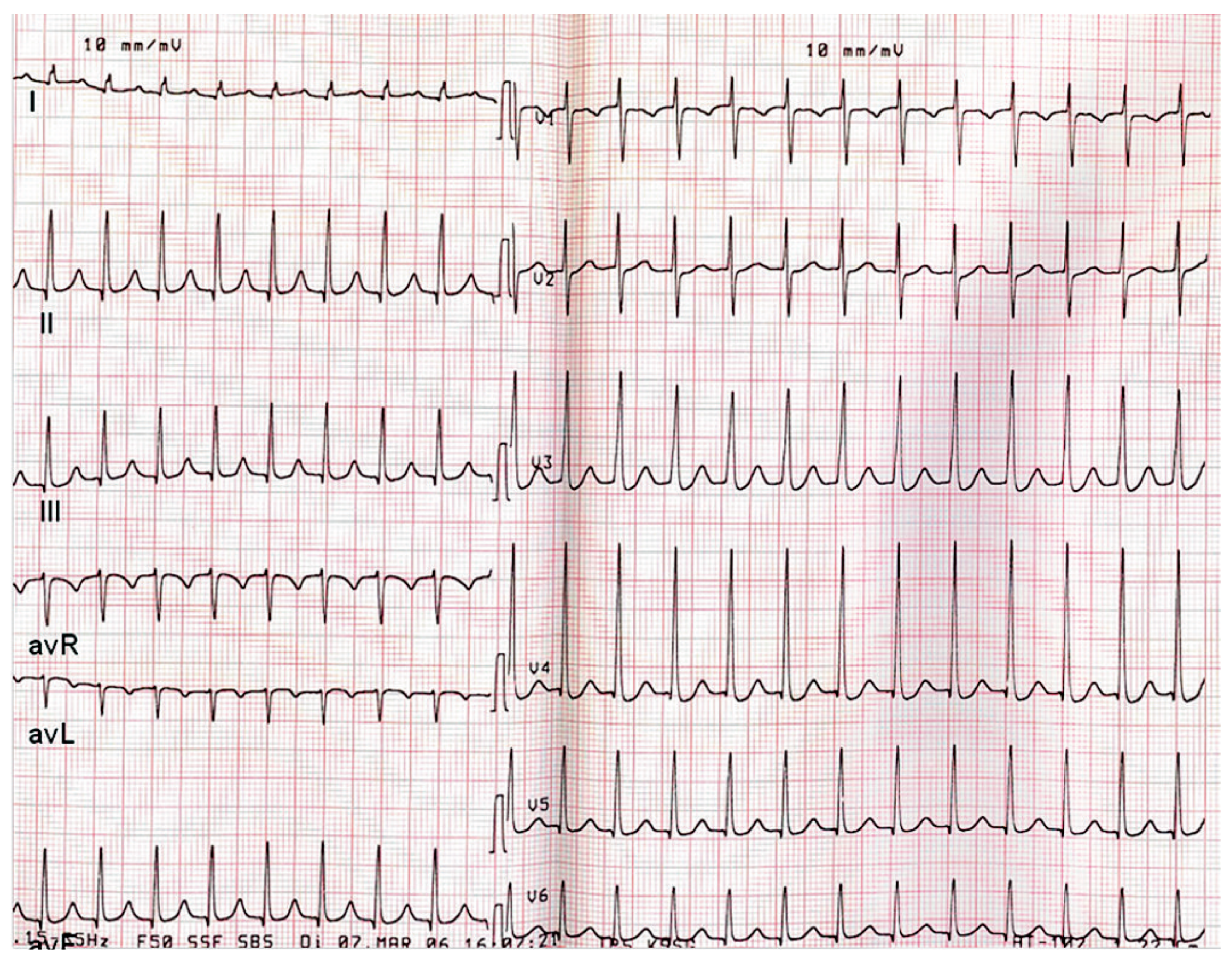 Cardiovascmed 12 00251 g002 Cardiovascmed 12 00251 g002