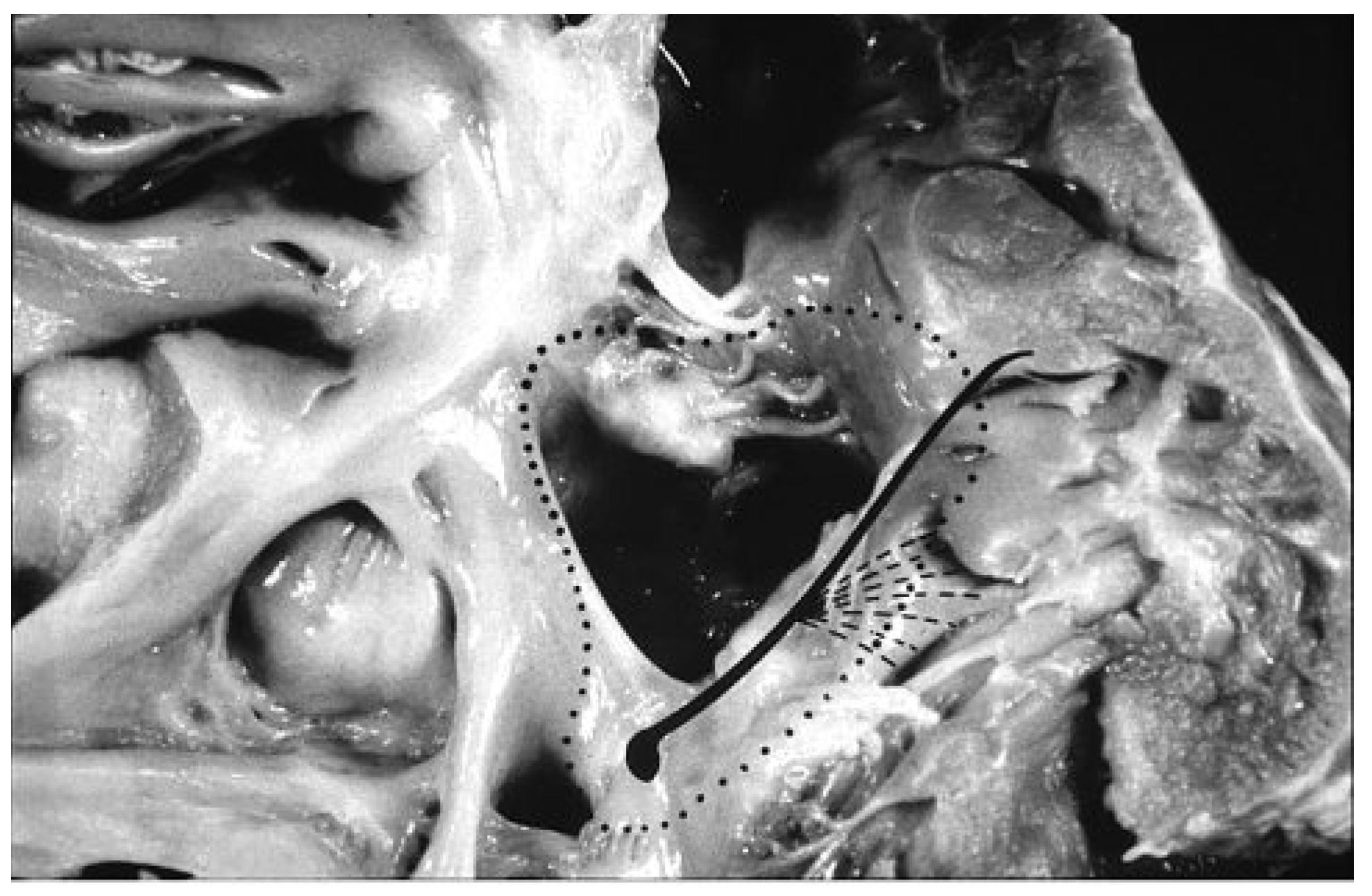 Cardiovascmed 13 00041 g003