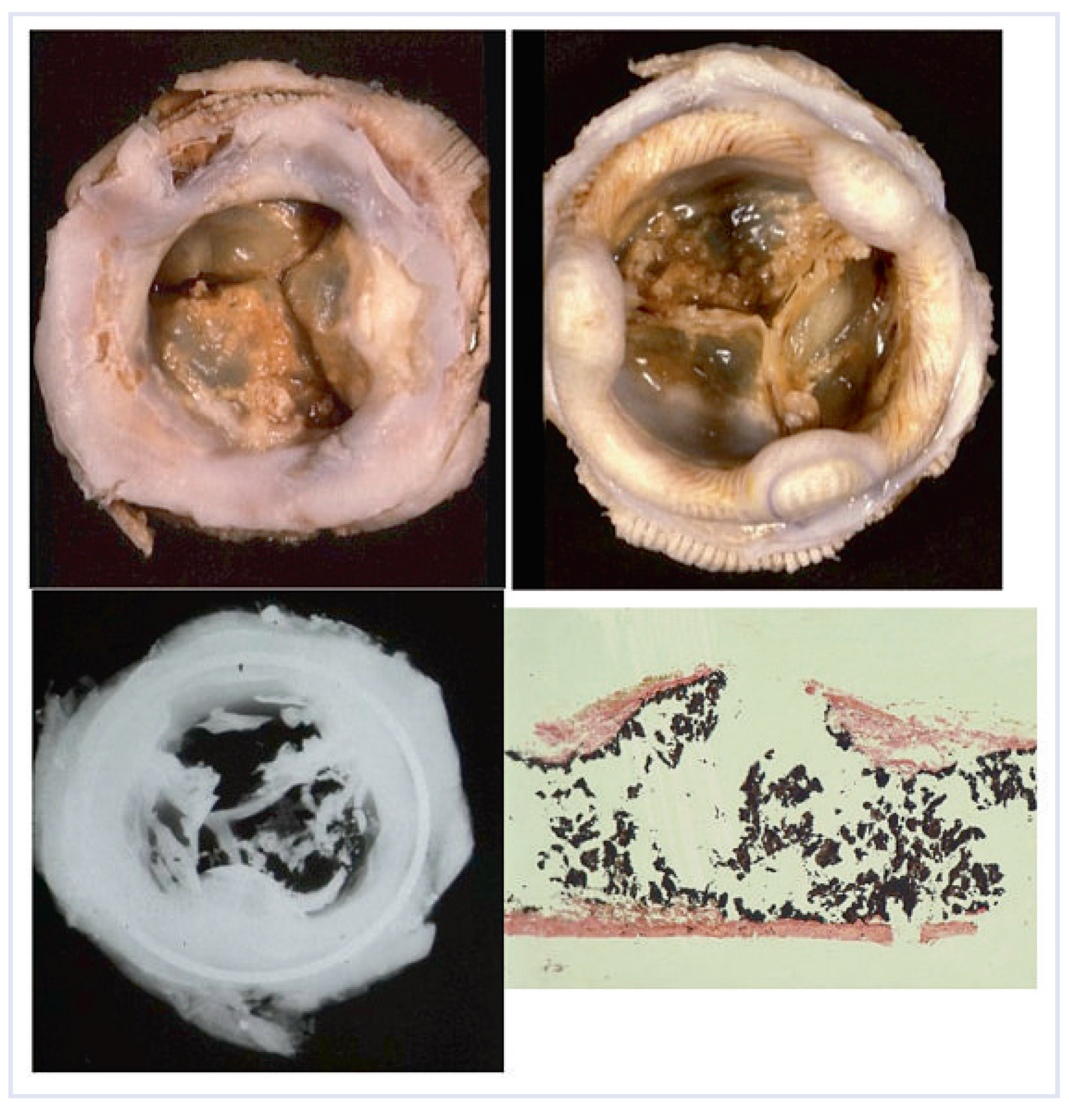 Cardiovascmed 13 00041 g004