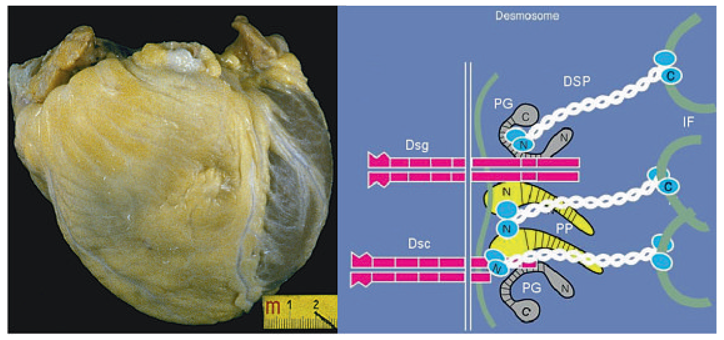 Cardiovascmed 13 00041 g006