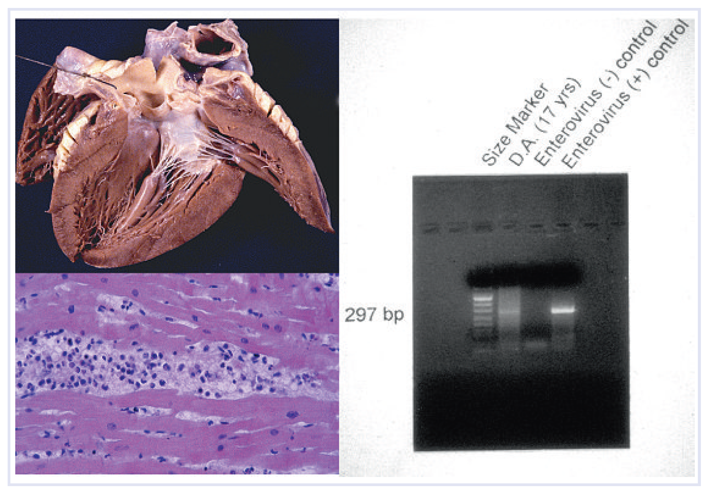 Cardiovascmed 13 00041 g008