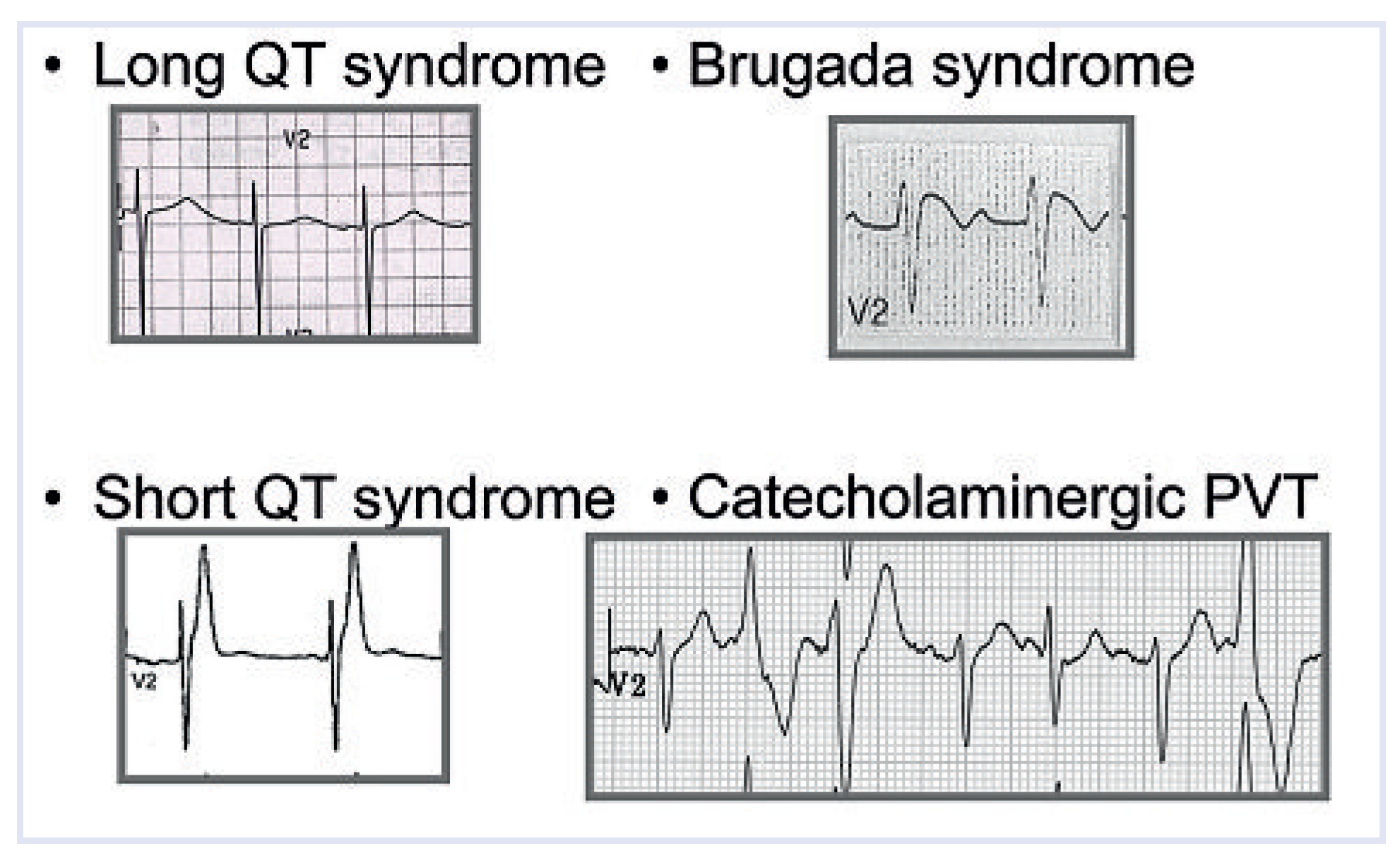 Cardiovascmed 13 00041 g009