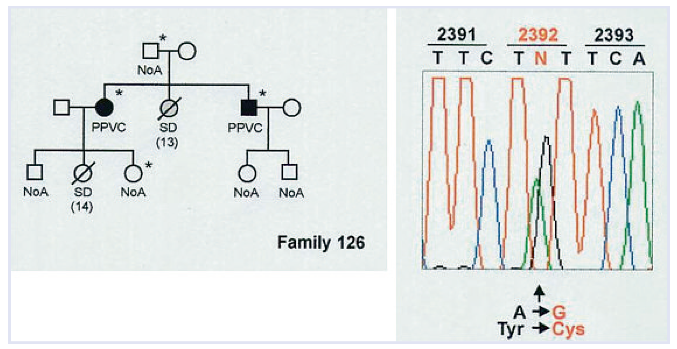 Cardiovascmed 13 00041 g010